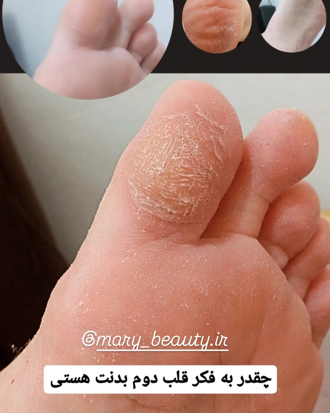 نمونه کار مریم سوخته زاری — لیفت و لمینت مژه