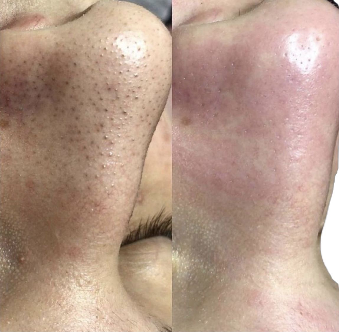 نمونه کار فاطمه خالقی — لیفت و لمینت مژه