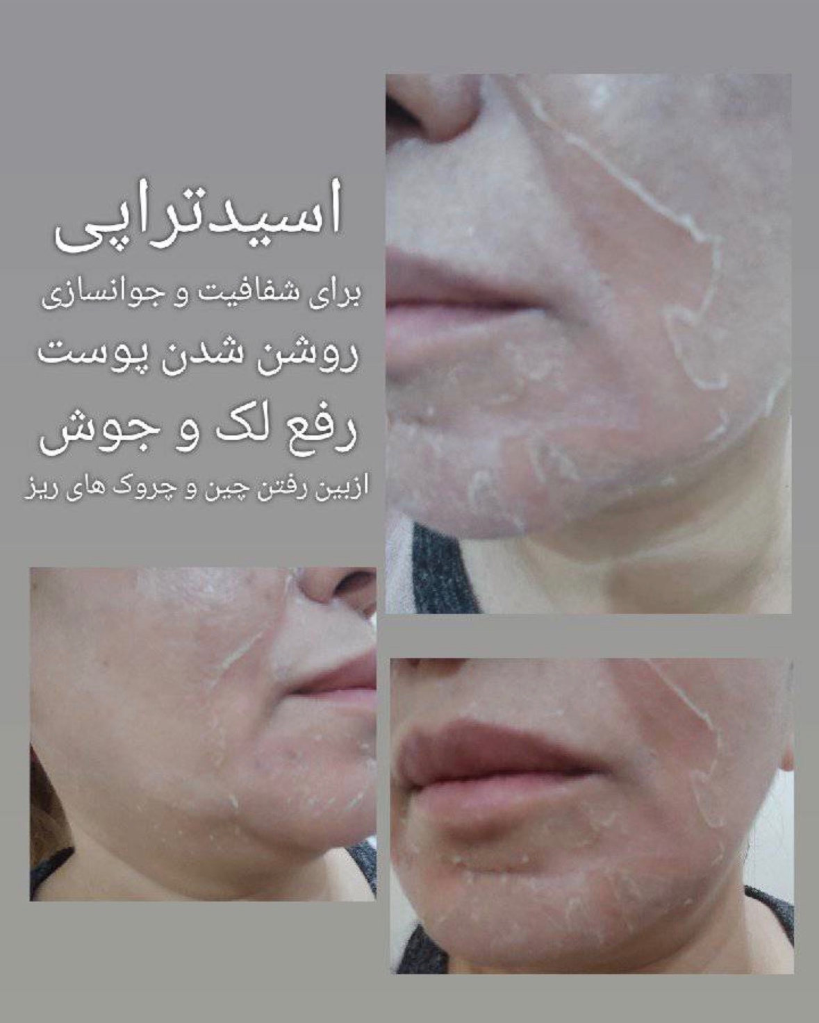نمونه کار فاطمه خالقی — لیفت و لمینت مژه