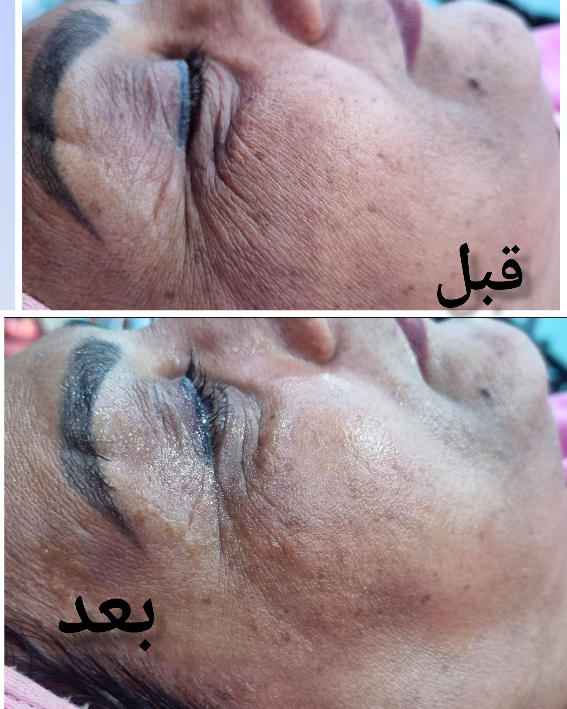 نمونه کار سوده سبزه‌پرور — لیفت و لمینت مژه