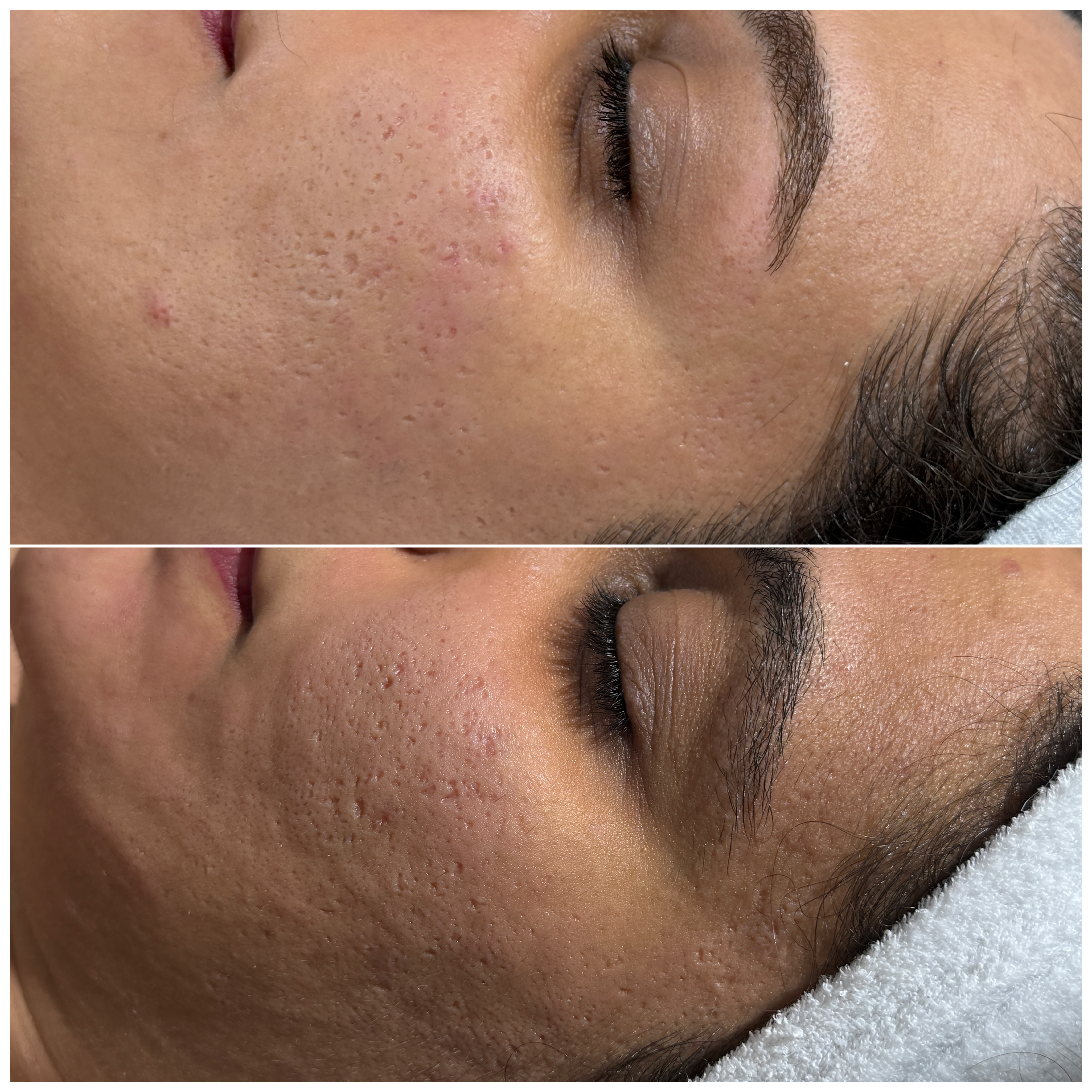 نمونه کار راضیه اسماعیل زاده — لیفت و لمینت مژه