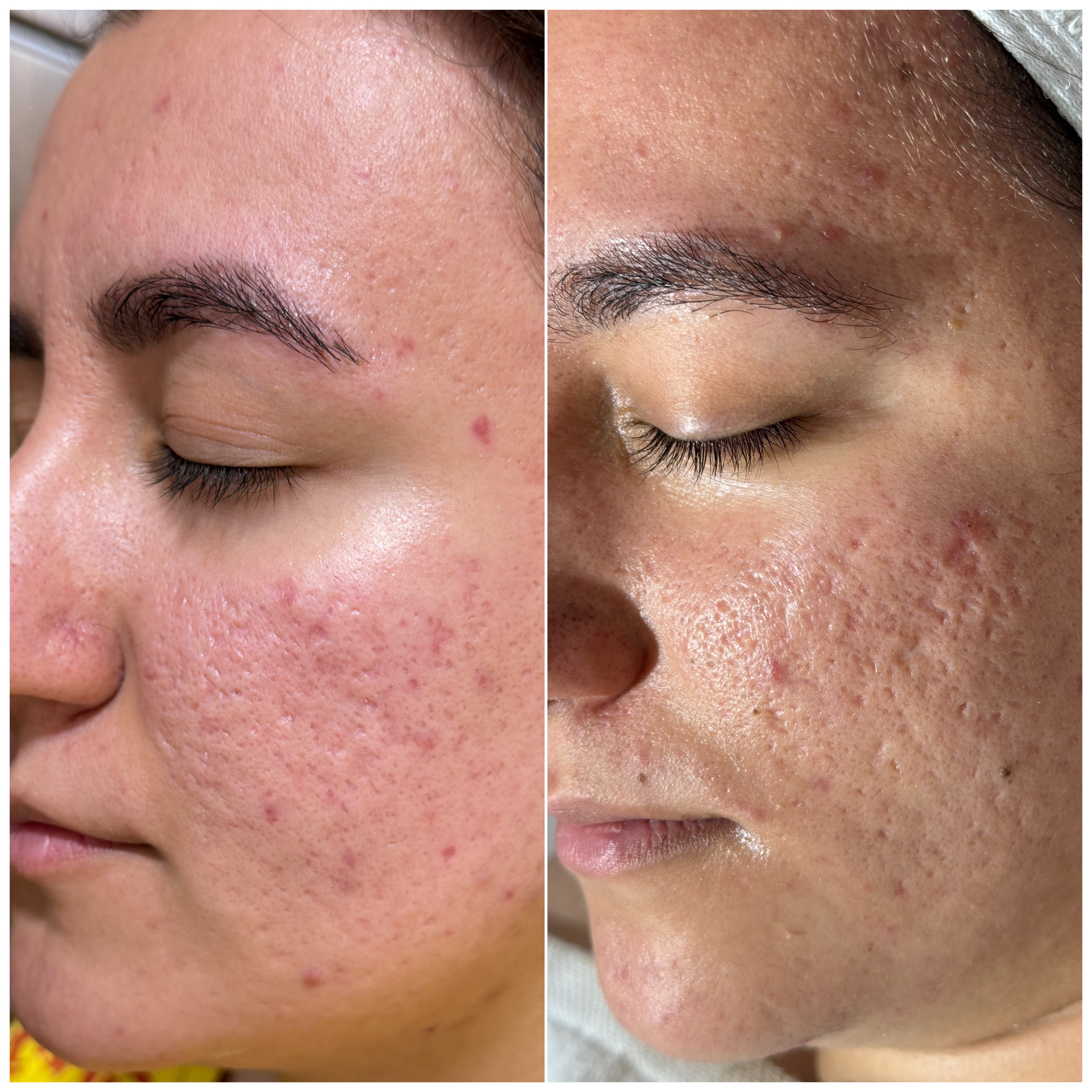 نمونه کار راضیه اسماعیل زاده — لیفت و لمینت مژه