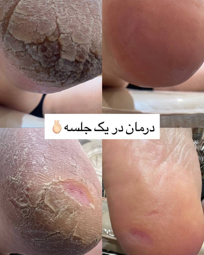نمونه کار بهار عباس پور — لیفت و لمینت مژه