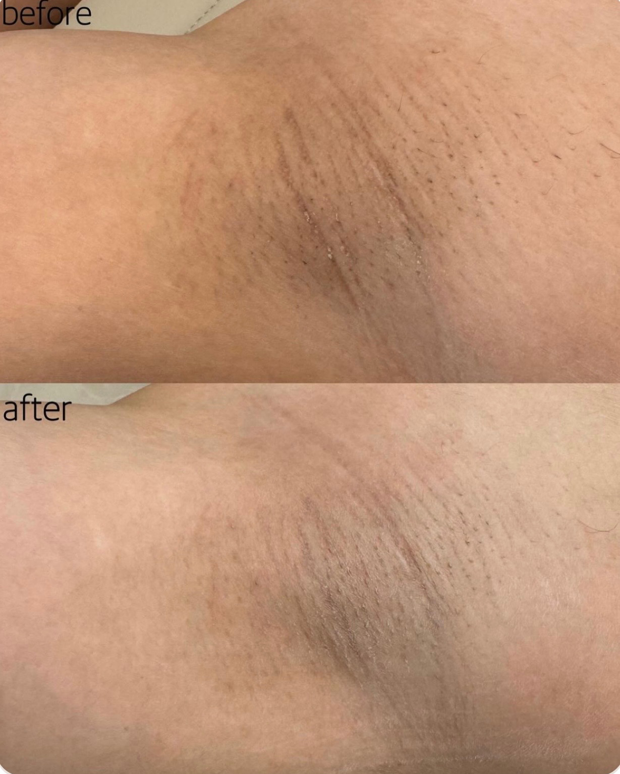 نمونه کار کیمیا حریری — لیفت و لمینت مژه