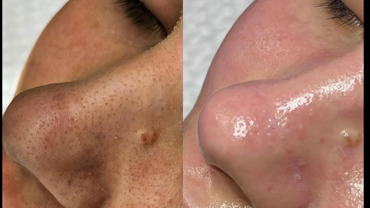 نمونه کار کیمیا حریری — لیفت و لمینت مژه