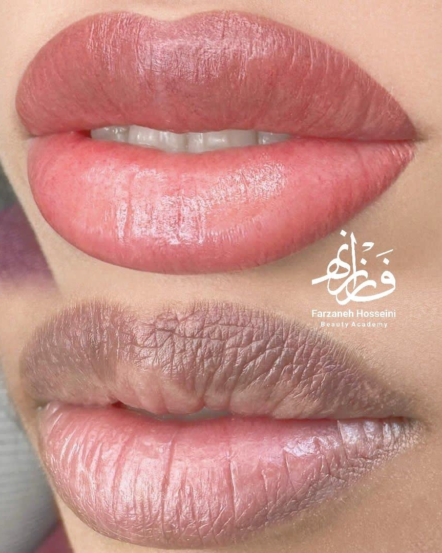 کاور پروفایل فرزانه حسینی — تصویر 1