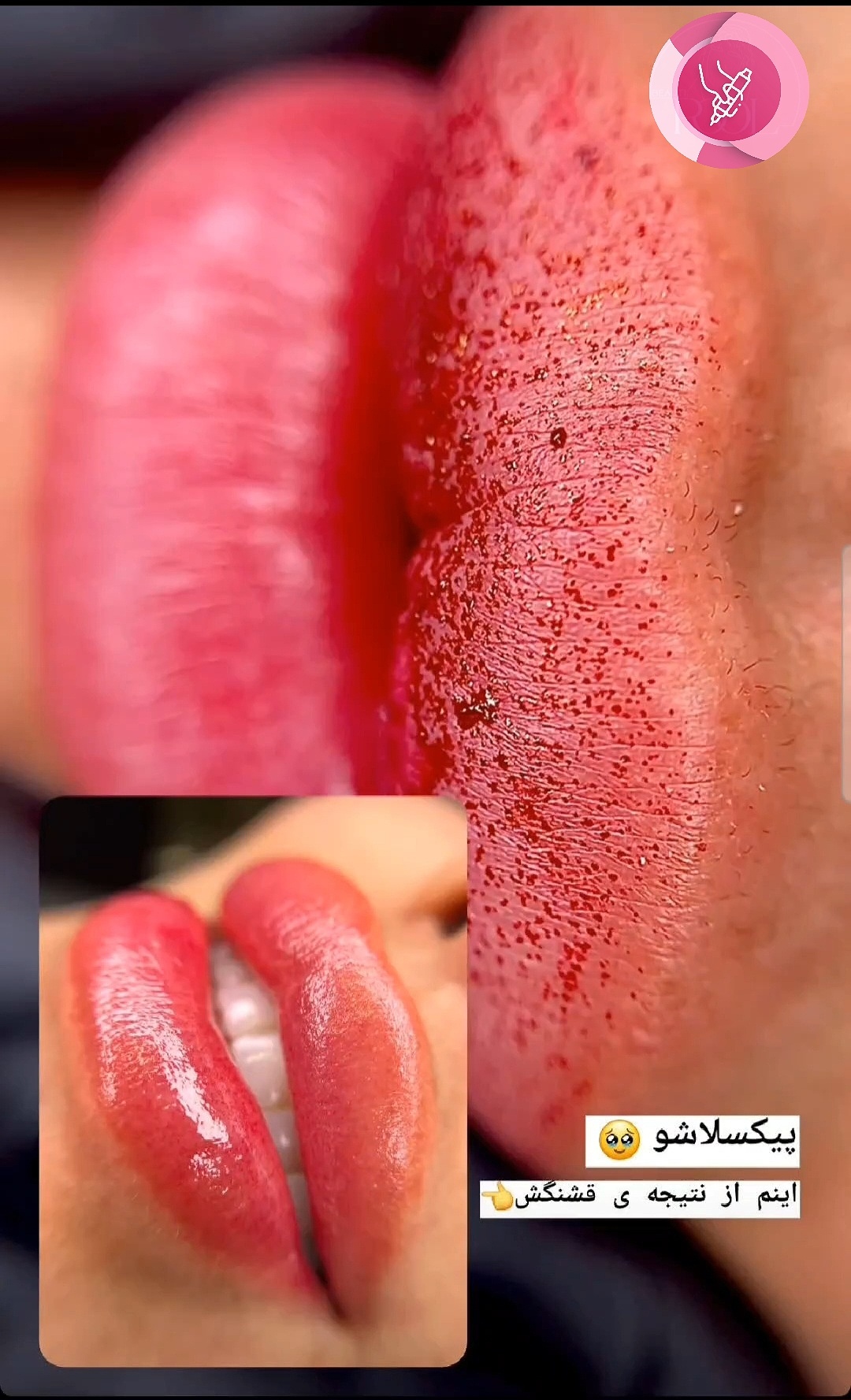 نمونه کار الهه شکری — لیفت و لمینت مژه