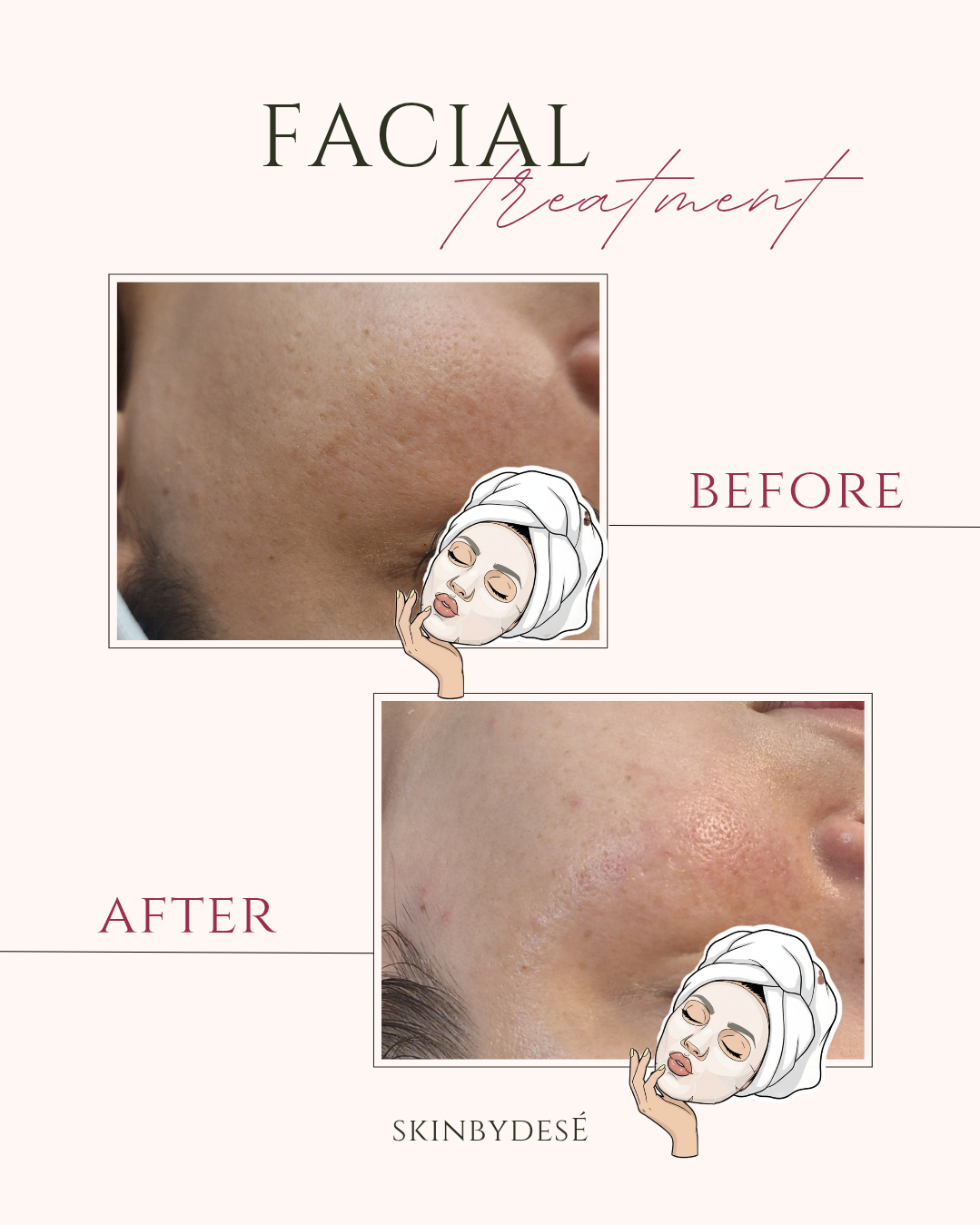 نمونه کار محدثه ستاریان — لیفت و لمینت مژه