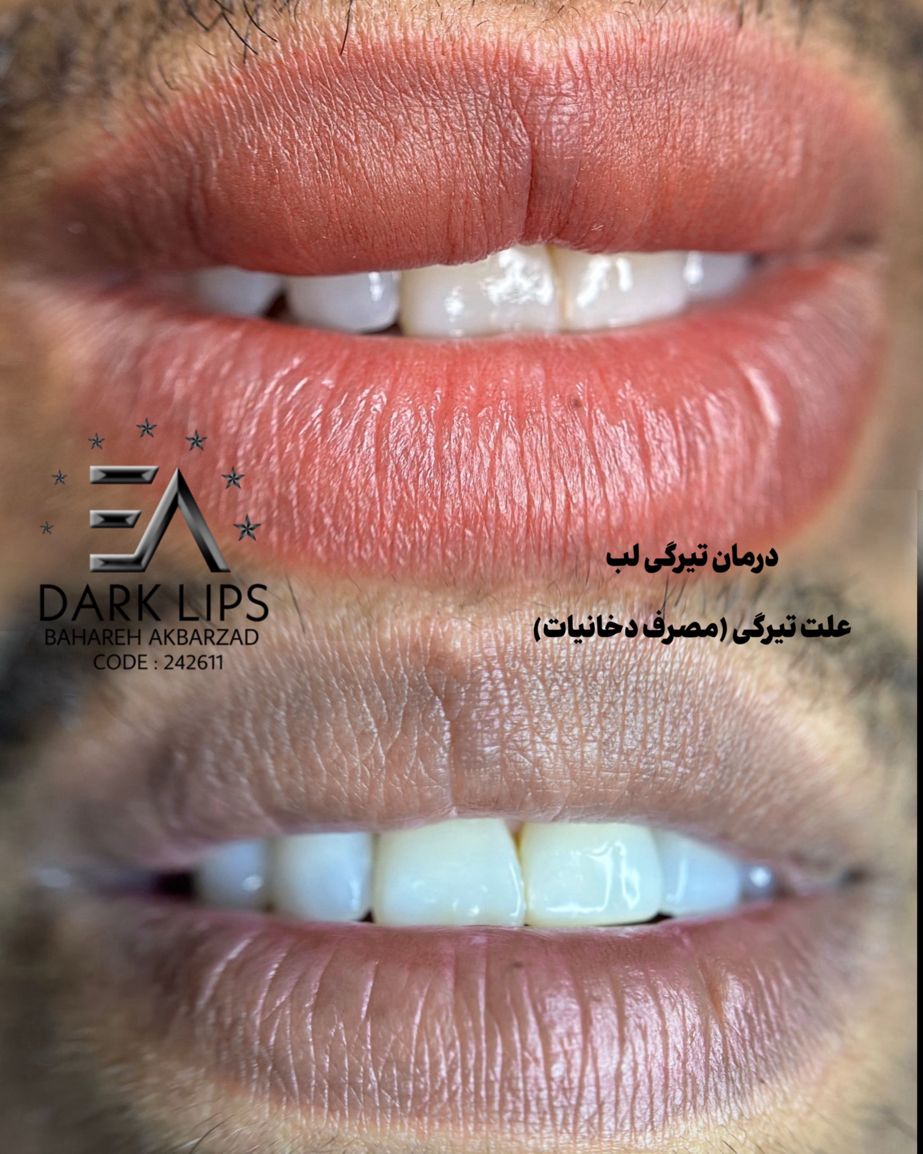 نمونه کار بهاره اکبرزاده — لیفت و لمینت مژه