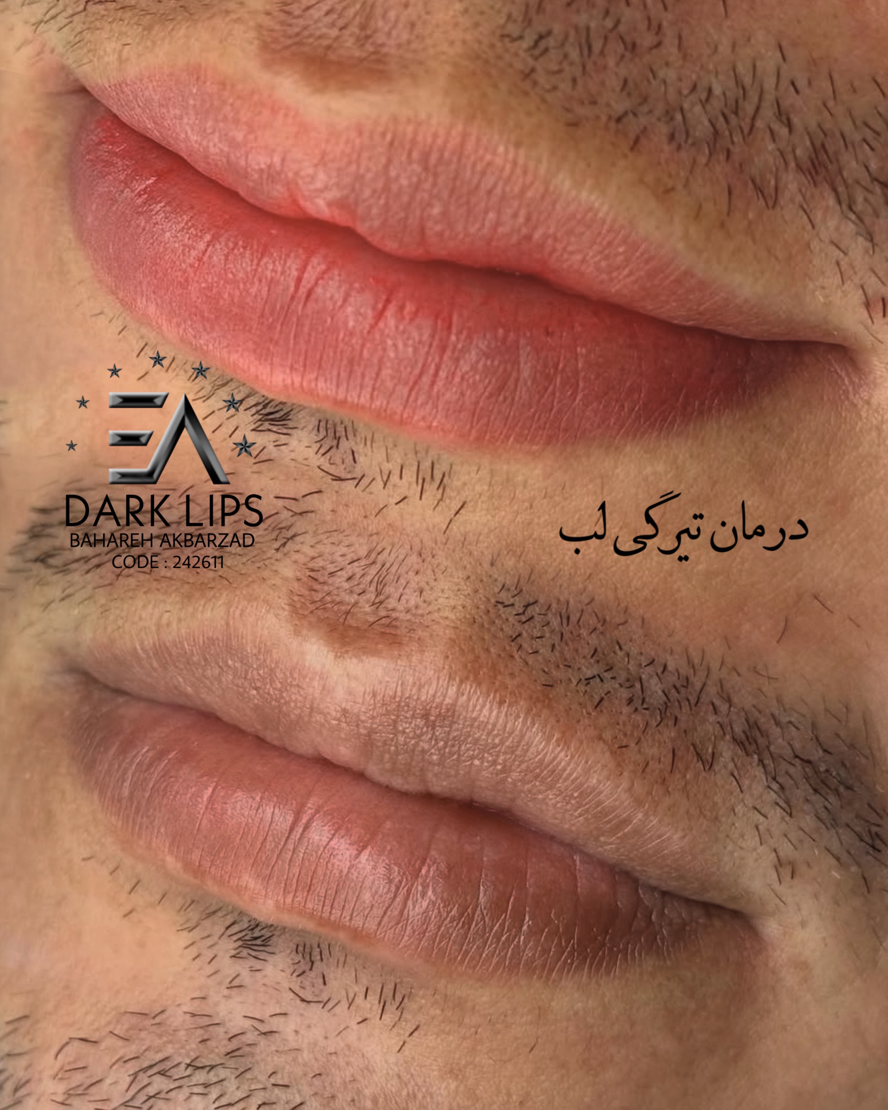 نمونه کار بهاره اکبرزاده — لیفت و لمینت مژه