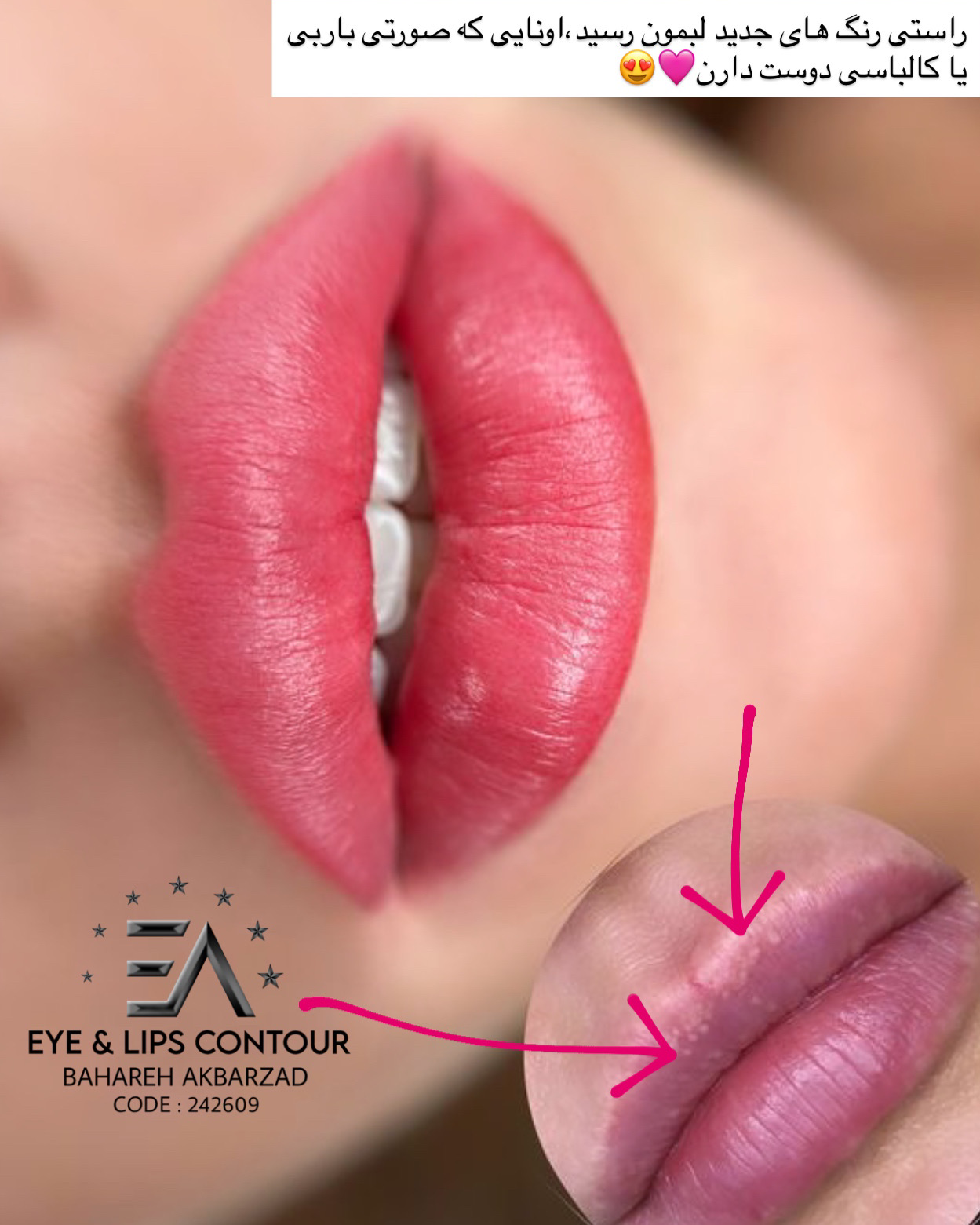 نمونه کار بهاره اکبرزاده — لیفت و لمینت مژه