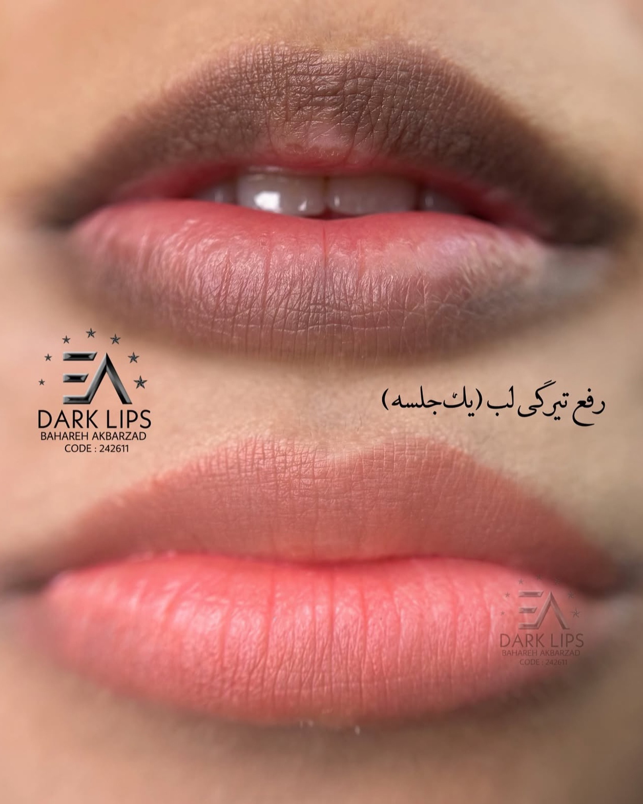 نمونه کار بهاره اکبرزاده — لیفت و لمینت مژه