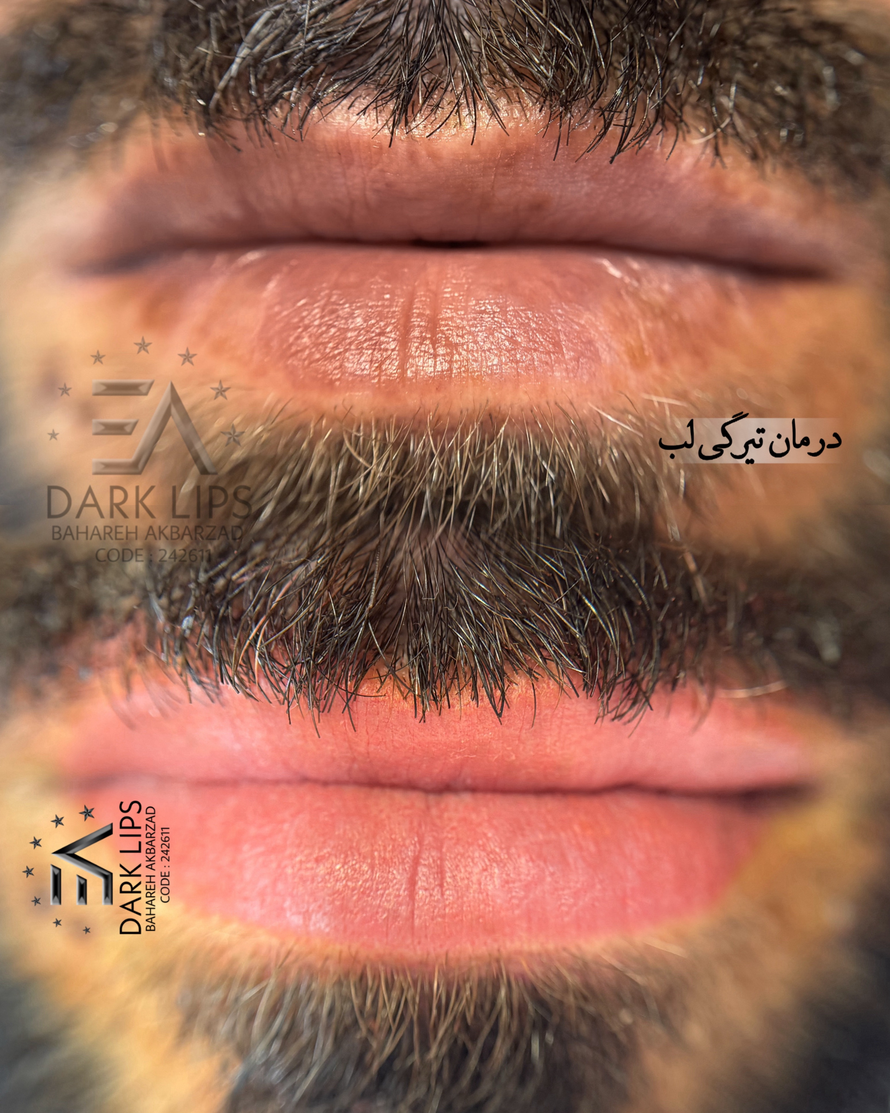 نمونه کار بهاره اکبرزاده — لیفت و لمینت مژه