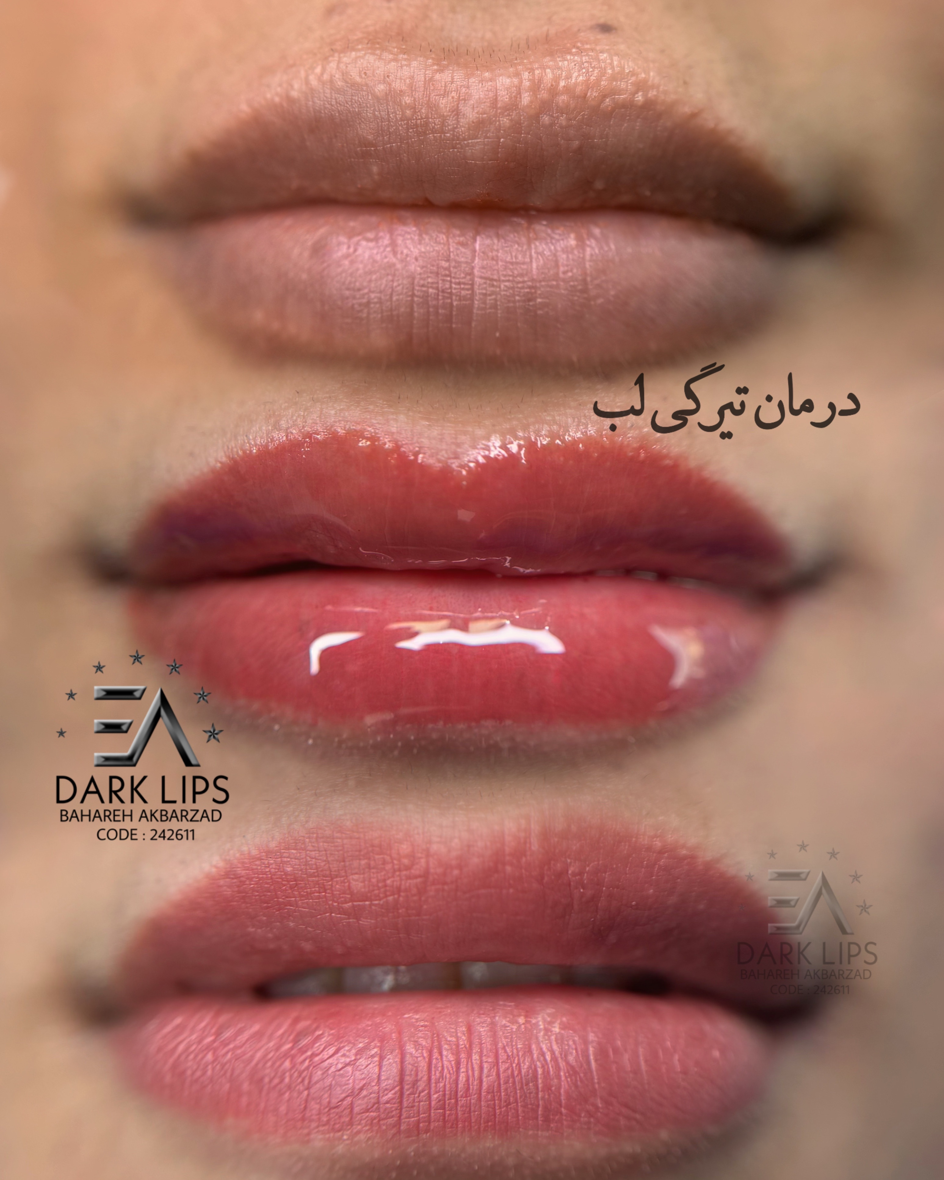 نمونه کار بهاره اکبرزاده — لیفت و لمینت مژه