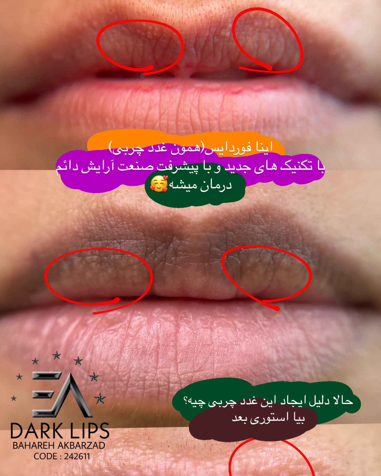نمونه کار بهاره اکبرزاده — لیفت و لمینت مژه