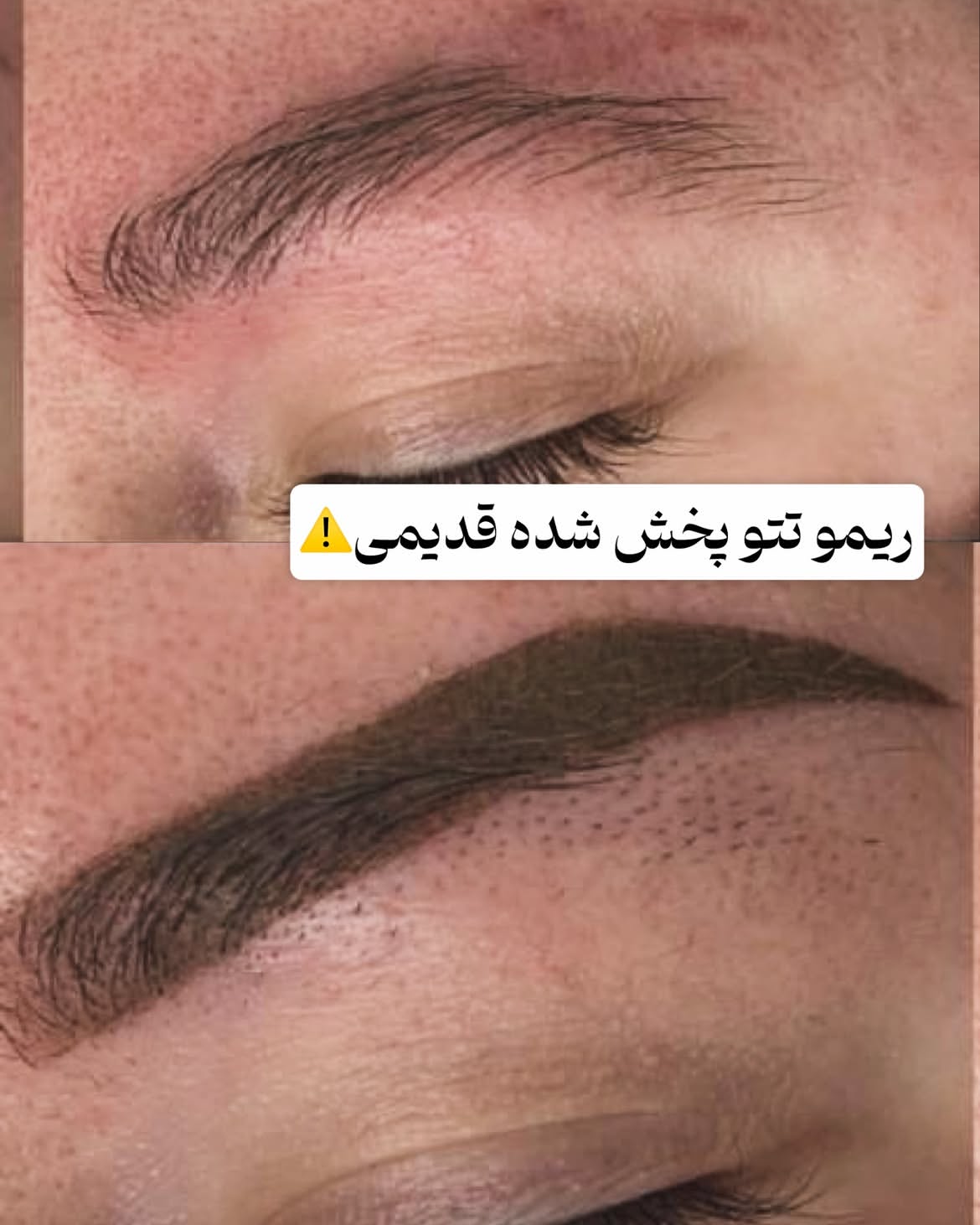 نمونه کار هستی صفرزاده — لیفت و لمینت مژه