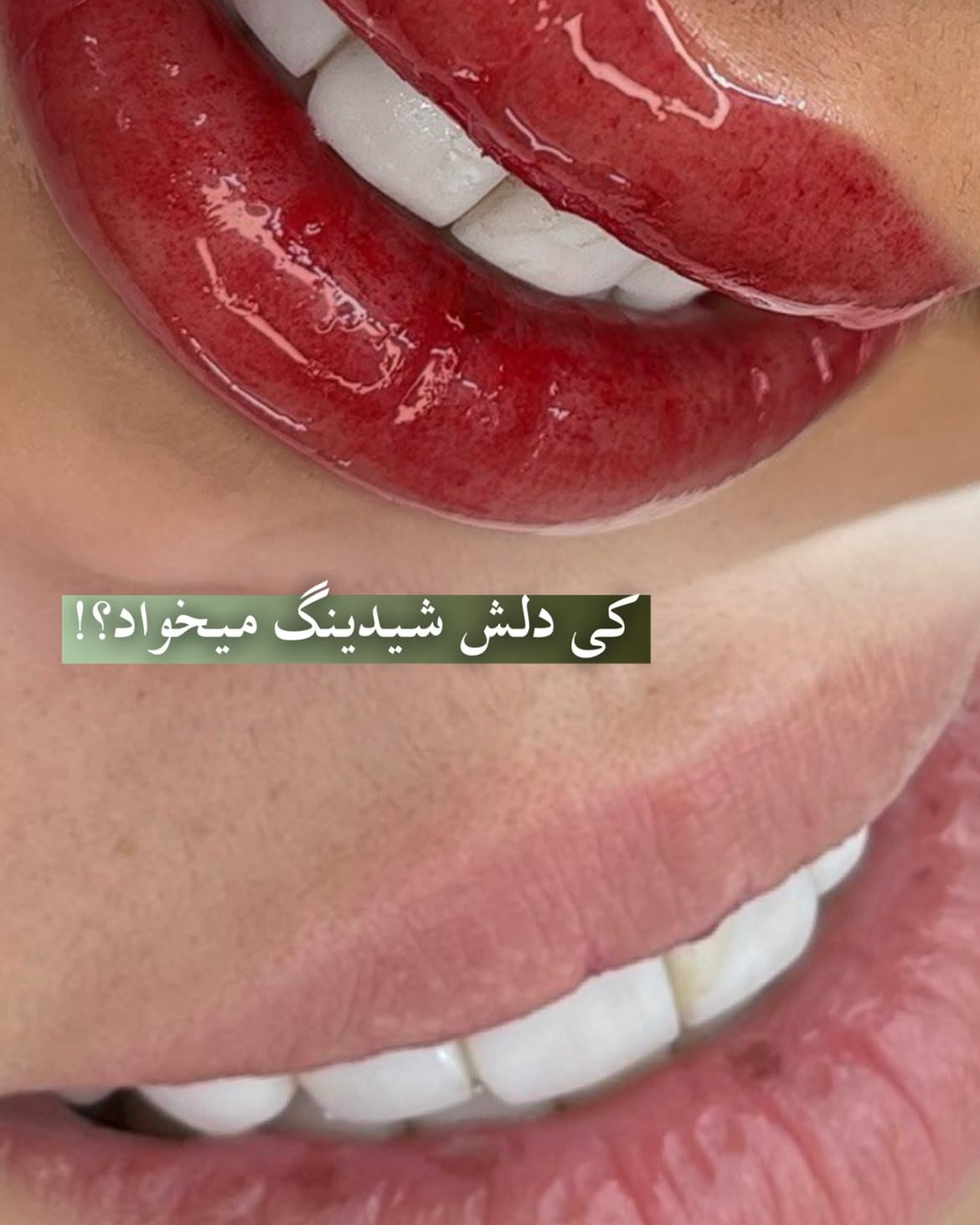 نمونه کار هستی صفرزاده — لیفت و لمینت مژه