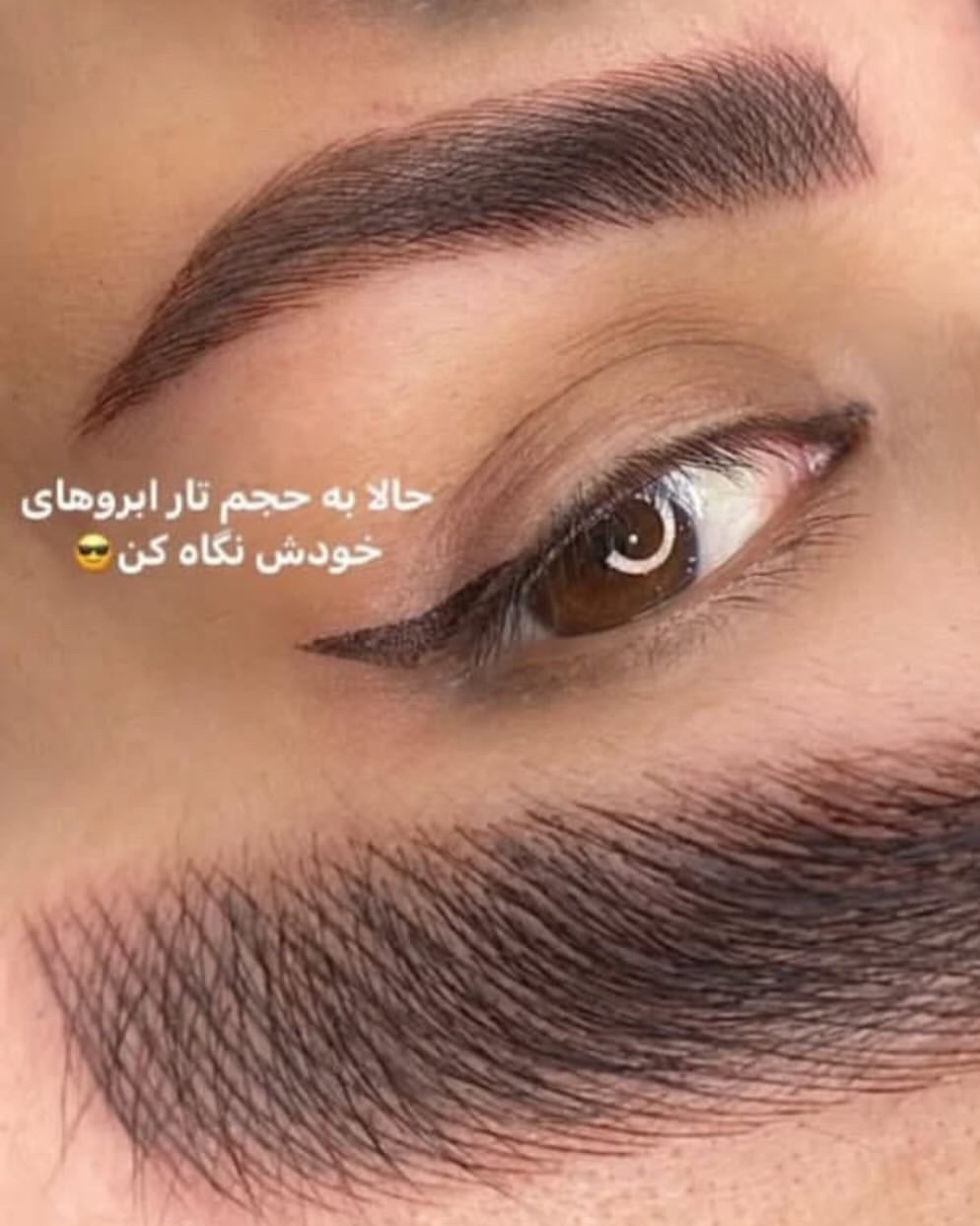نمونه کار هستی صفرزاده — لیفت و لمینت مژه