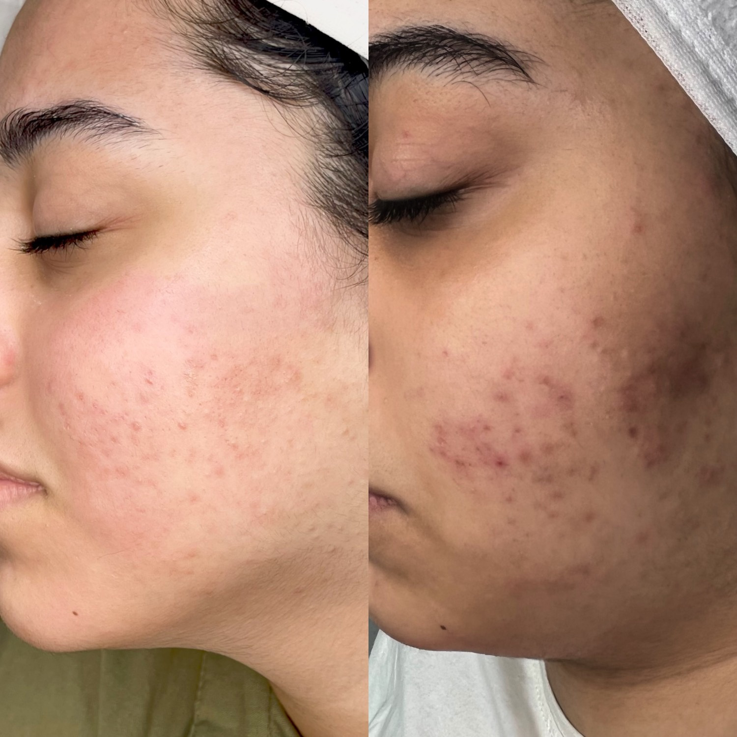 نمونه کار الناز قاسم زاده — لیفت و لمینت مژه