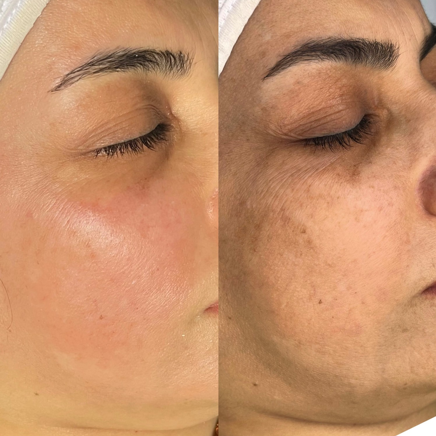 نمونه کار الناز قاسم زاده — لیفت و لمینت مژه