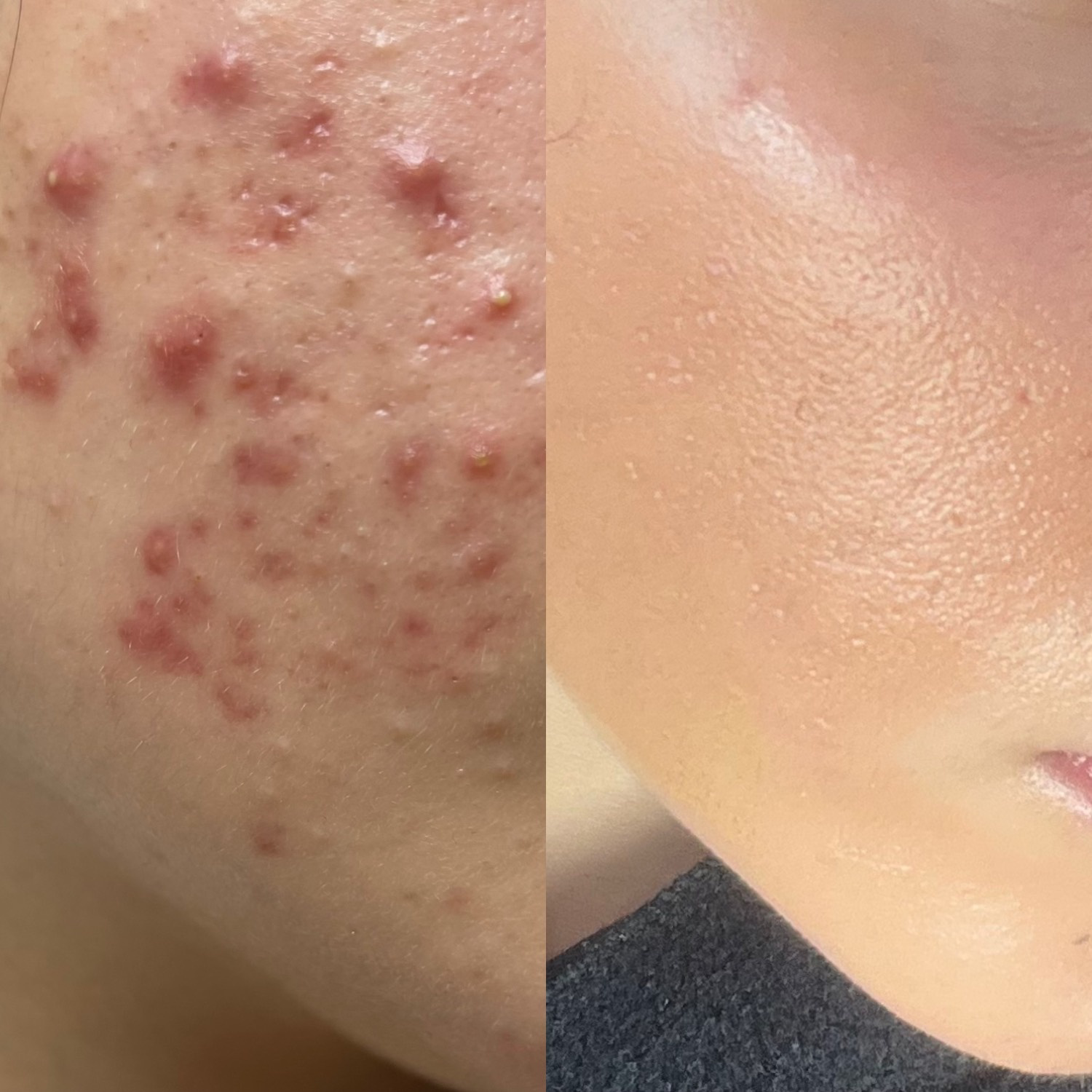 نمونه کار الناز قاسم زاده — لیفت و لمینت مژه