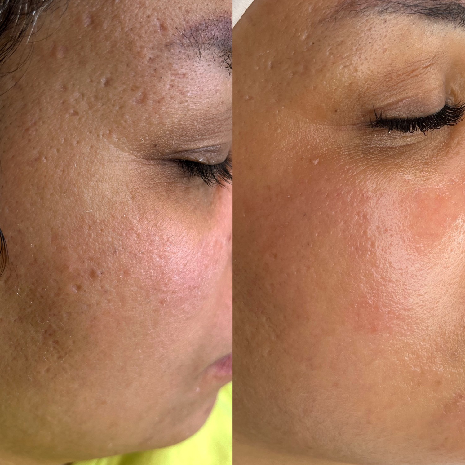 نمونه کار الناز قاسم زاده — لیفت و لمینت مژه
