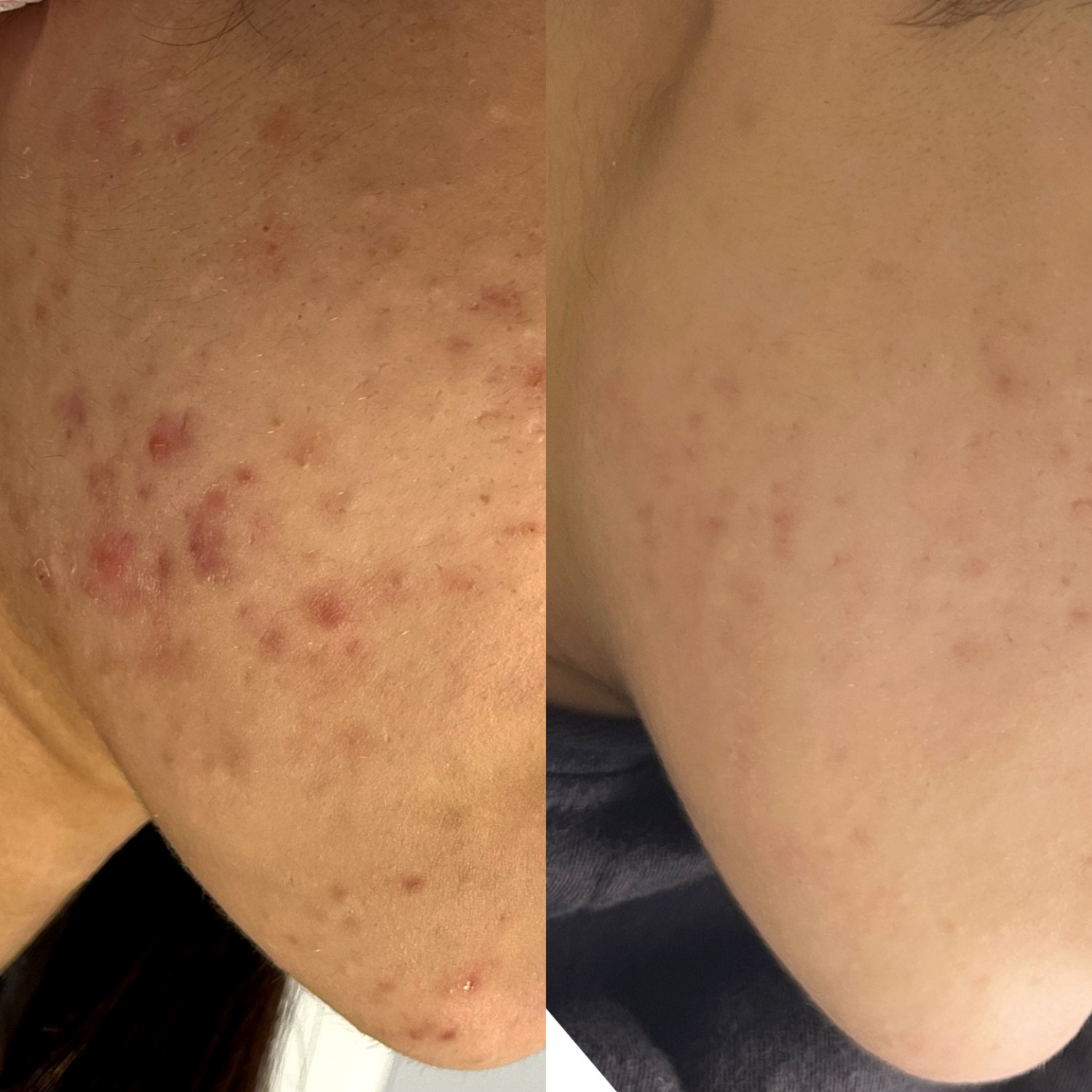 نمونه کار الناز قاسم زاده — لیفت و لمینت مژه