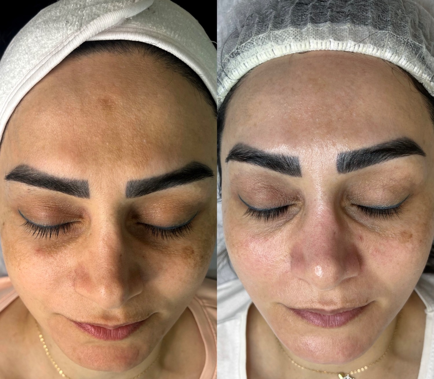 نمونه کار الناز قاسم زاده — لیفت و لمینت مژه