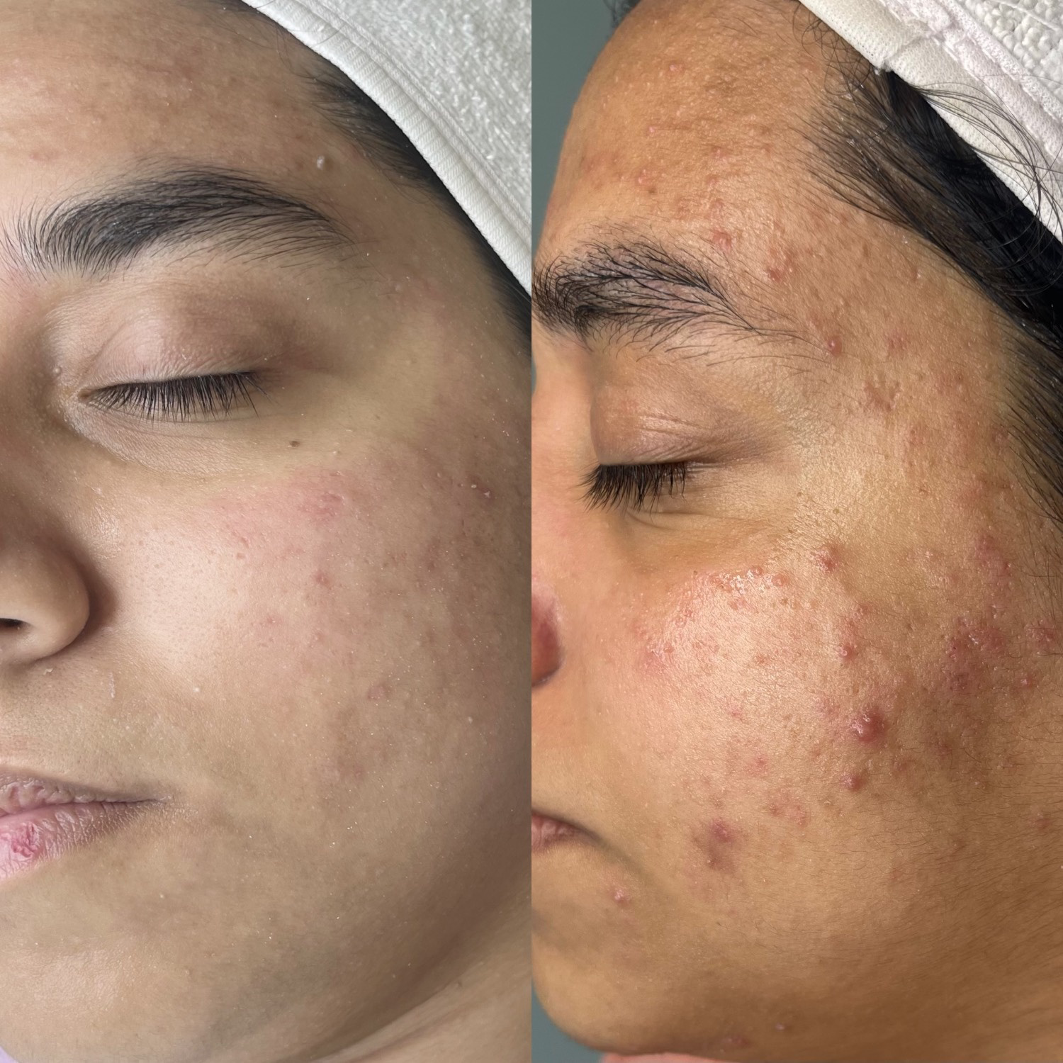 نمونه کار الناز قاسم زاده — لیفت و لمینت مژه