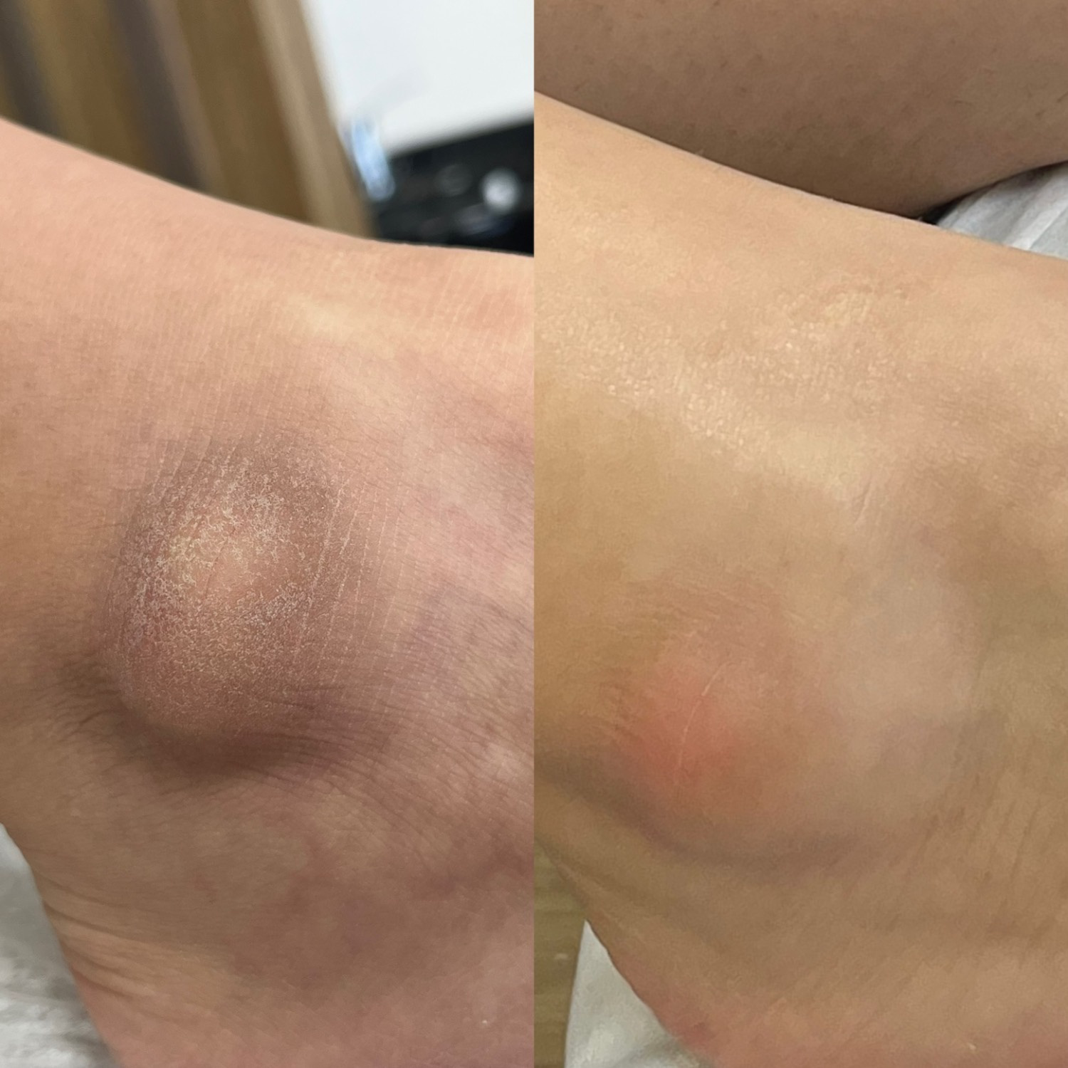 نمونه کار الناز قاسم زاده — لیفت و لمینت مژه