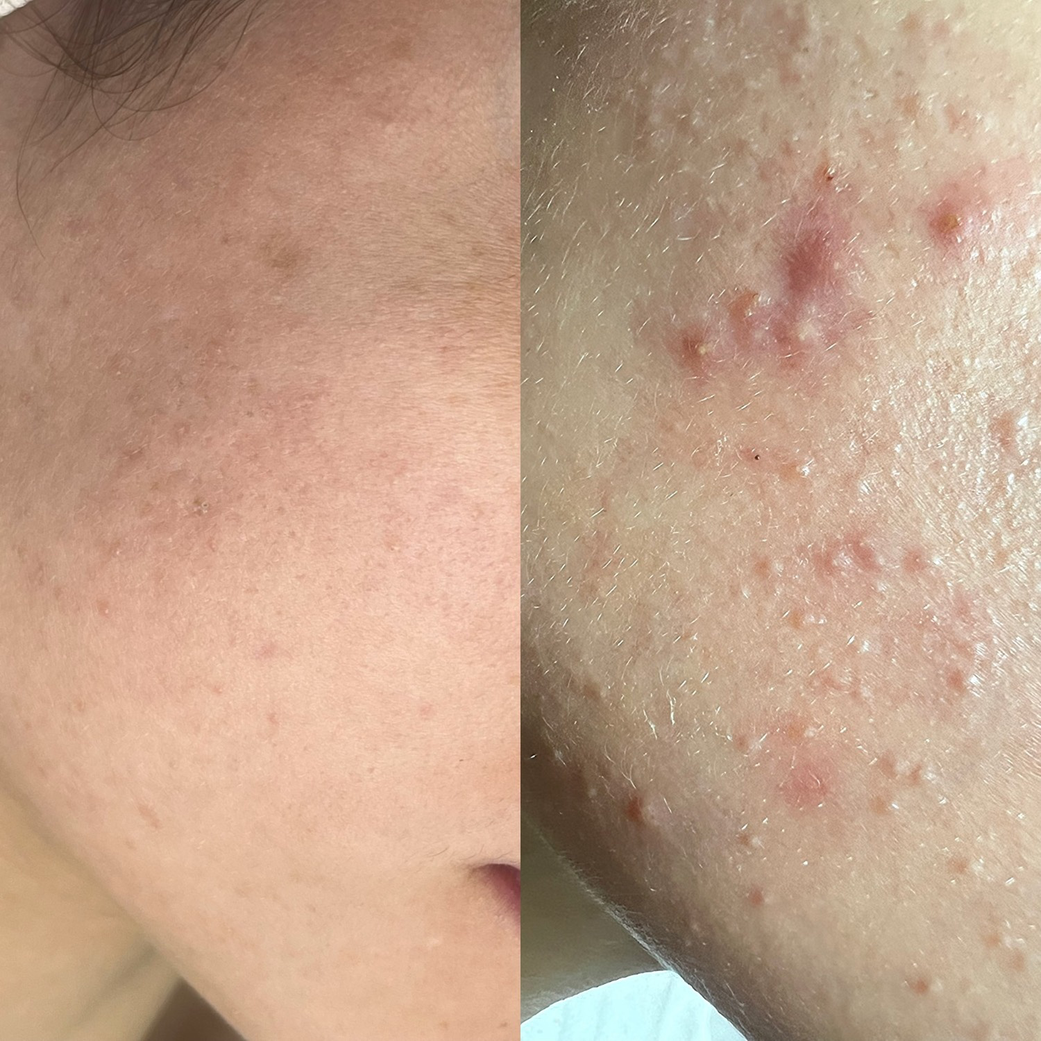 نمونه کار الناز قاسم زاده — لیفت و لمینت مژه