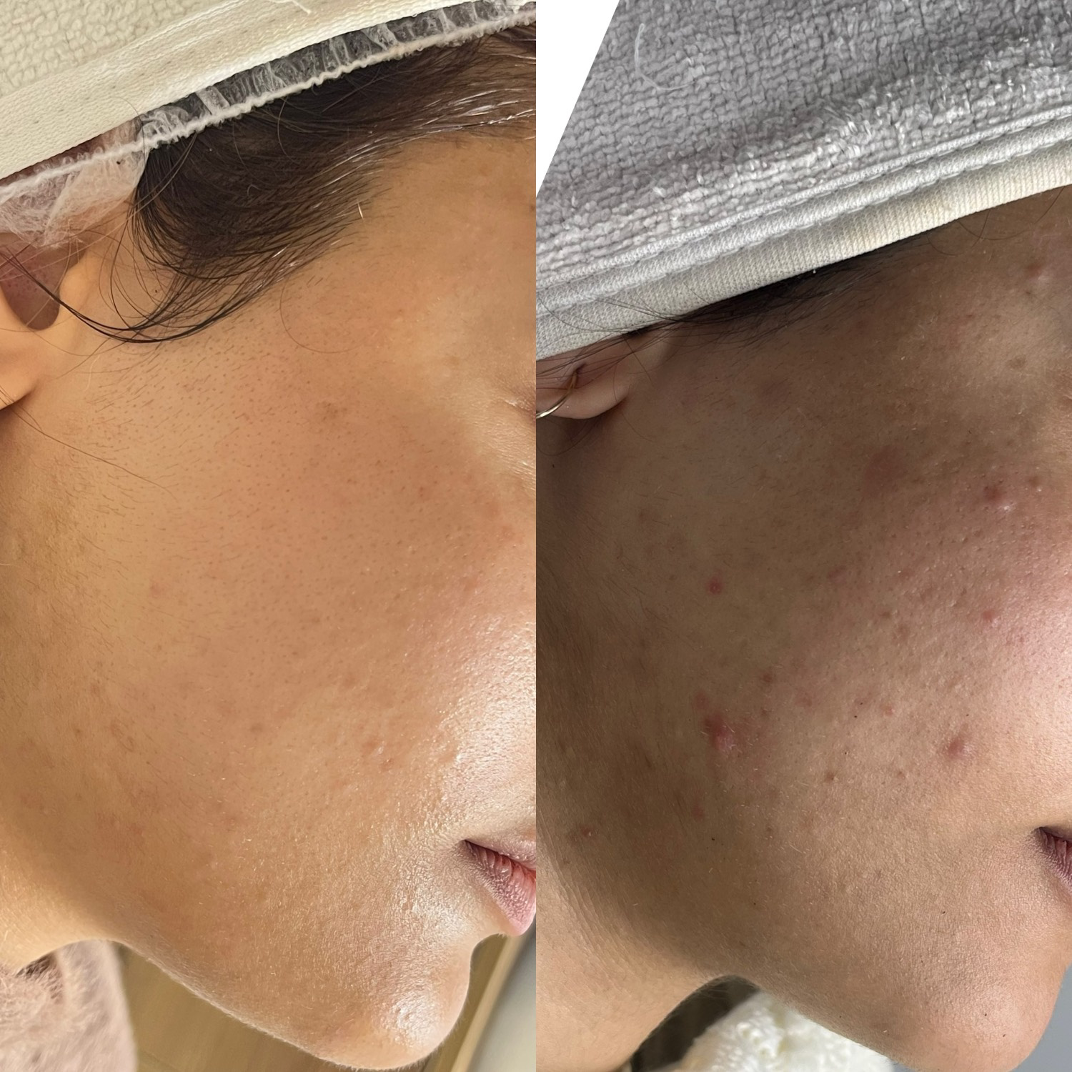 نمونه کار الناز قاسم زاده — لیفت و لمینت مژه