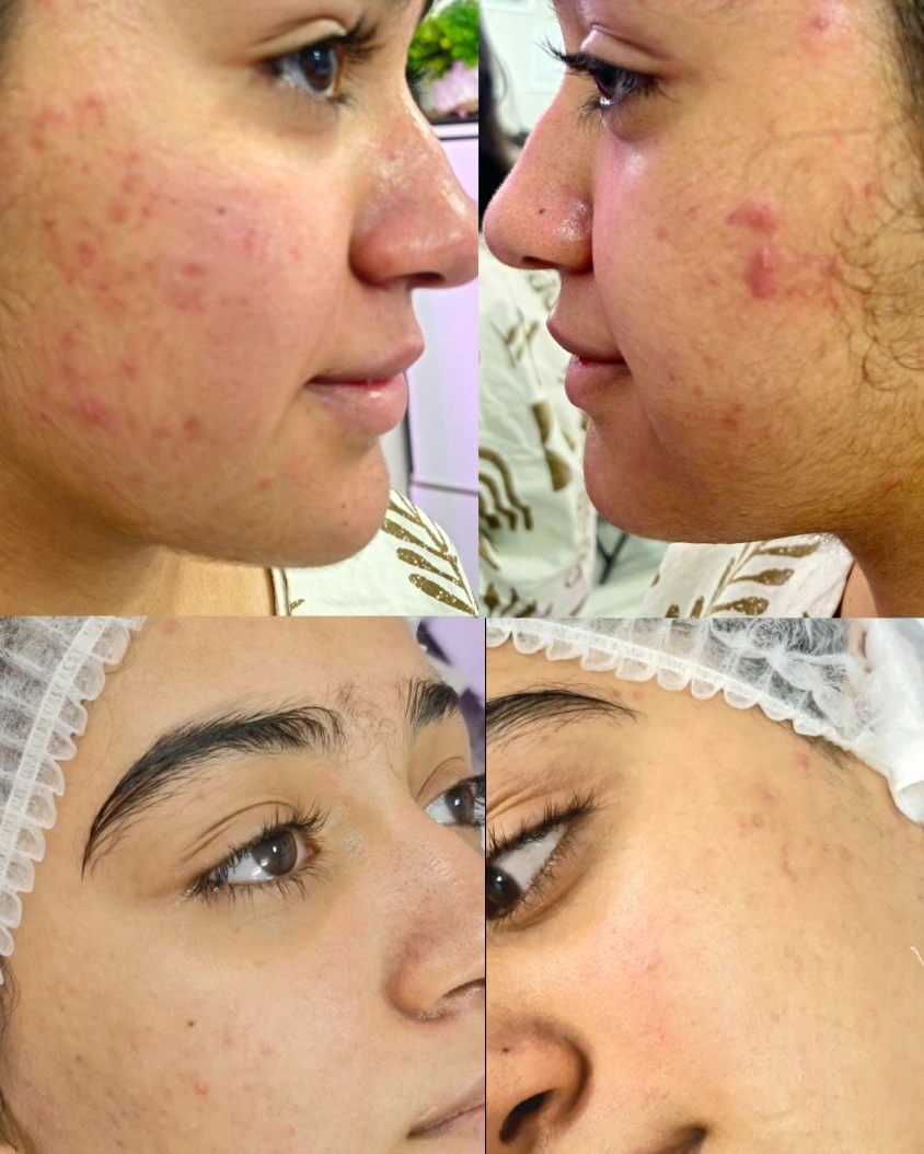 نمونه کار الهه آقایی — لیفت و لمینت مژه