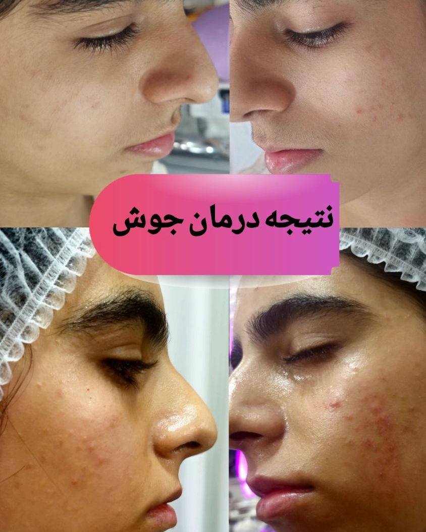نمونه کار الهه آقایی — لیفت و لمینت مژه