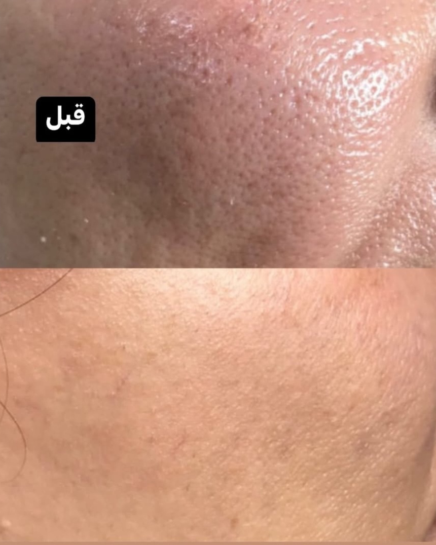 نمونه کار الهه آقایی — لیفت و لمینت مژه