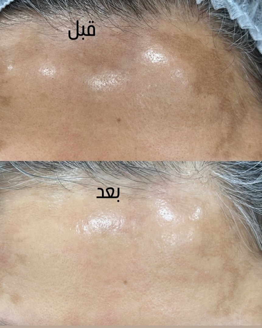 نمونه کار الهه آقایی — لیفت و لمینت مژه