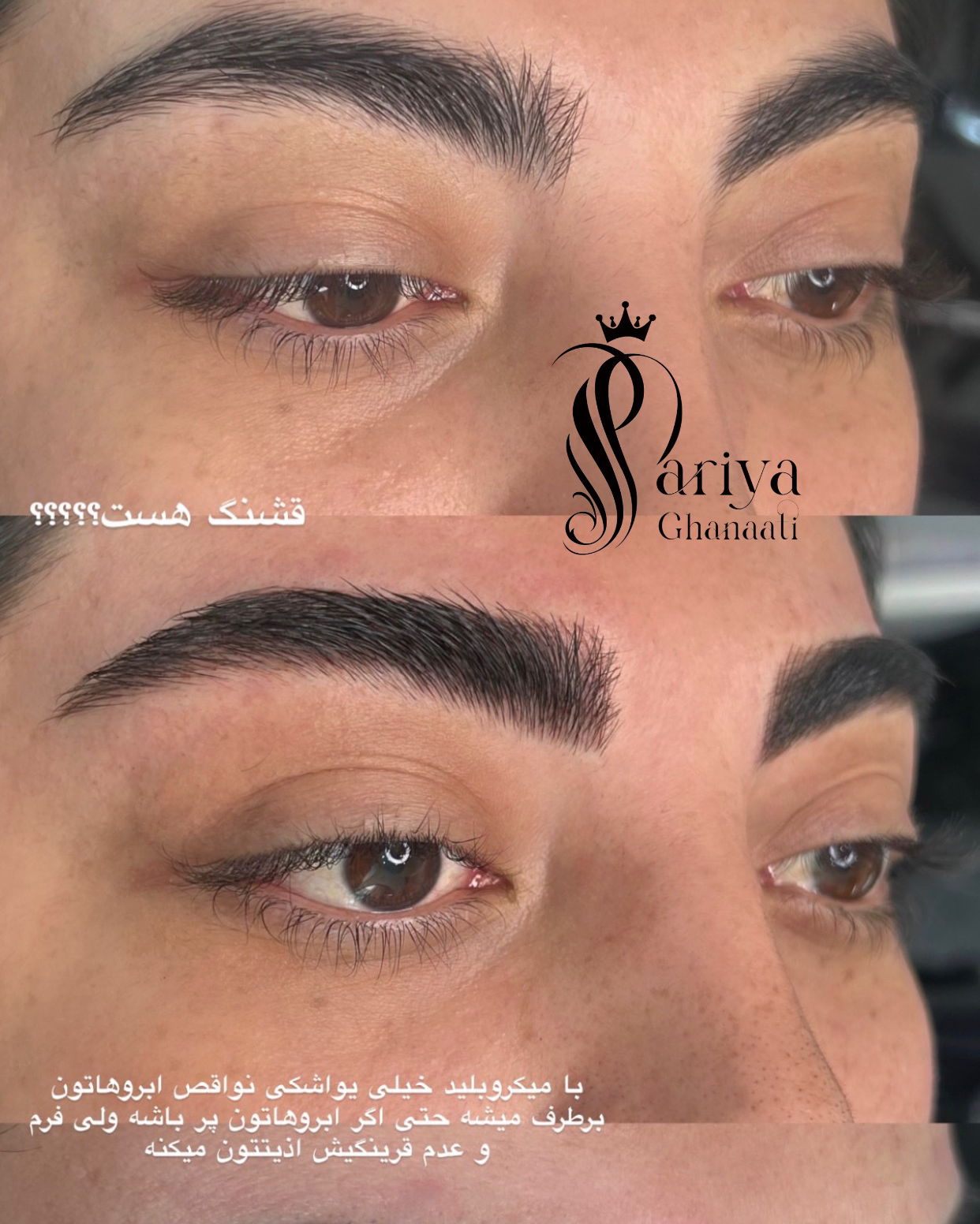 نمونه کار پریا قناعتی — لیفت و لمینت مژه