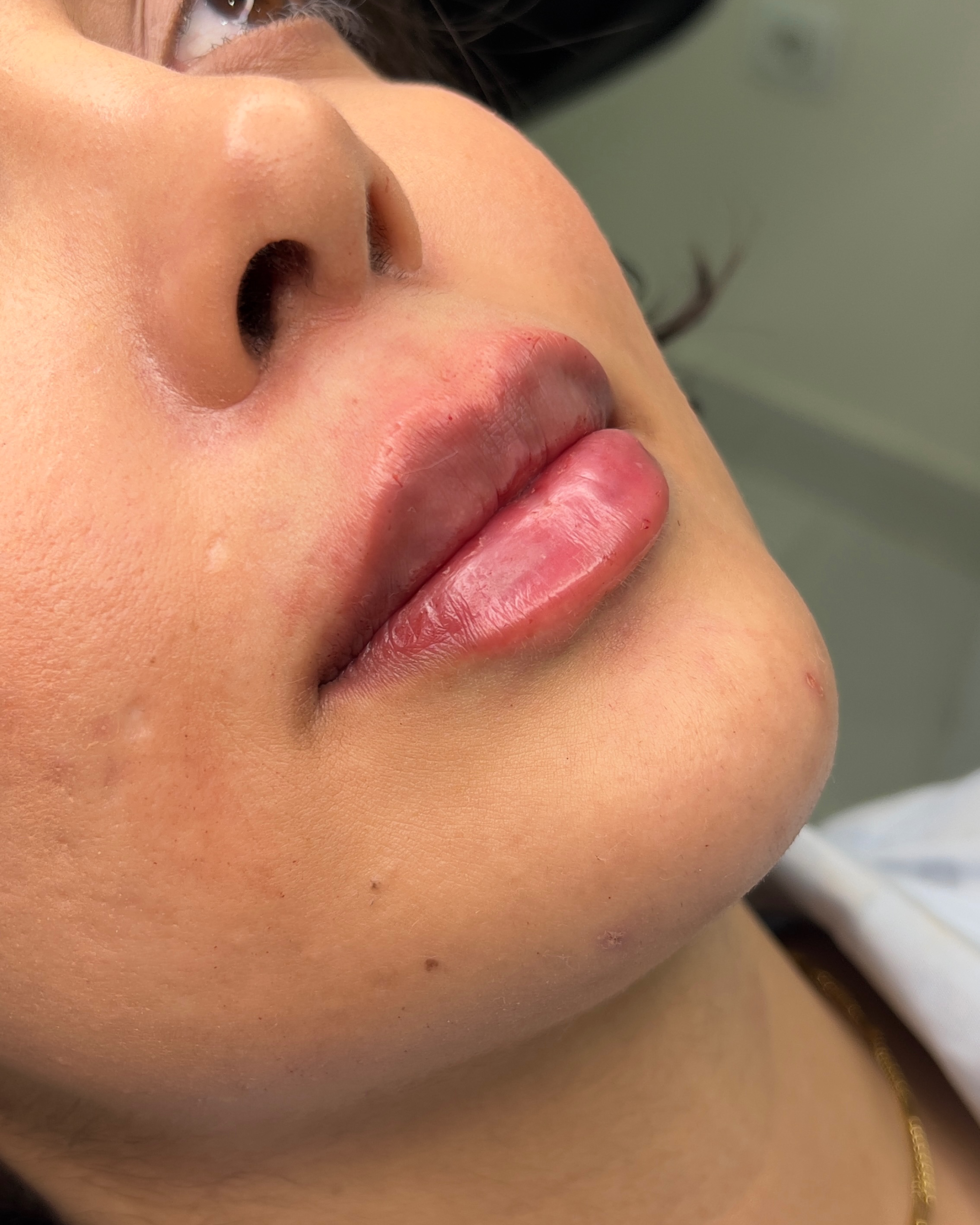 نمونه کار دکتر علی قصابان — لیفت و لمینت مژه