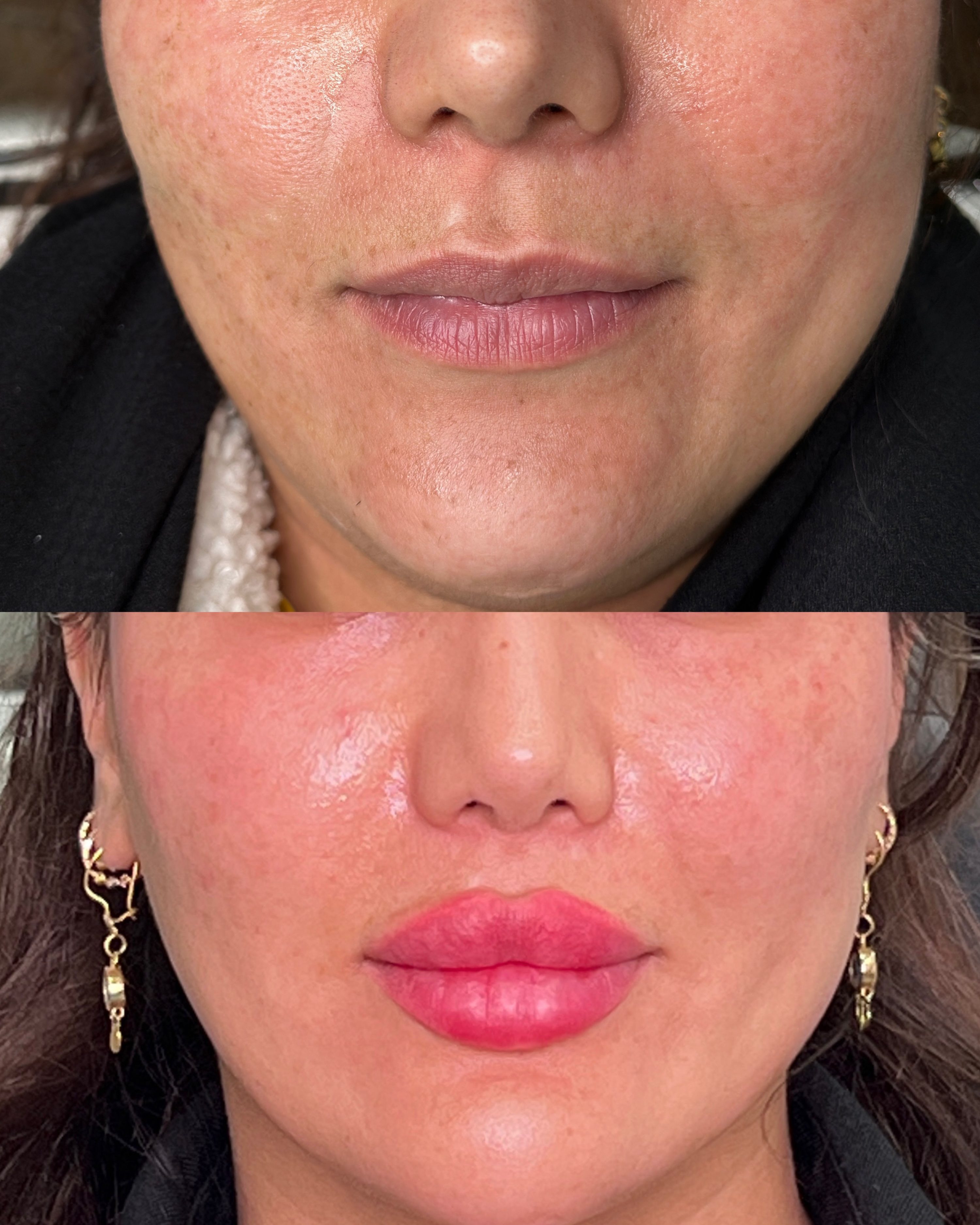 نمونه کار دکتر علی قصابان — لیفت و لمینت مژه