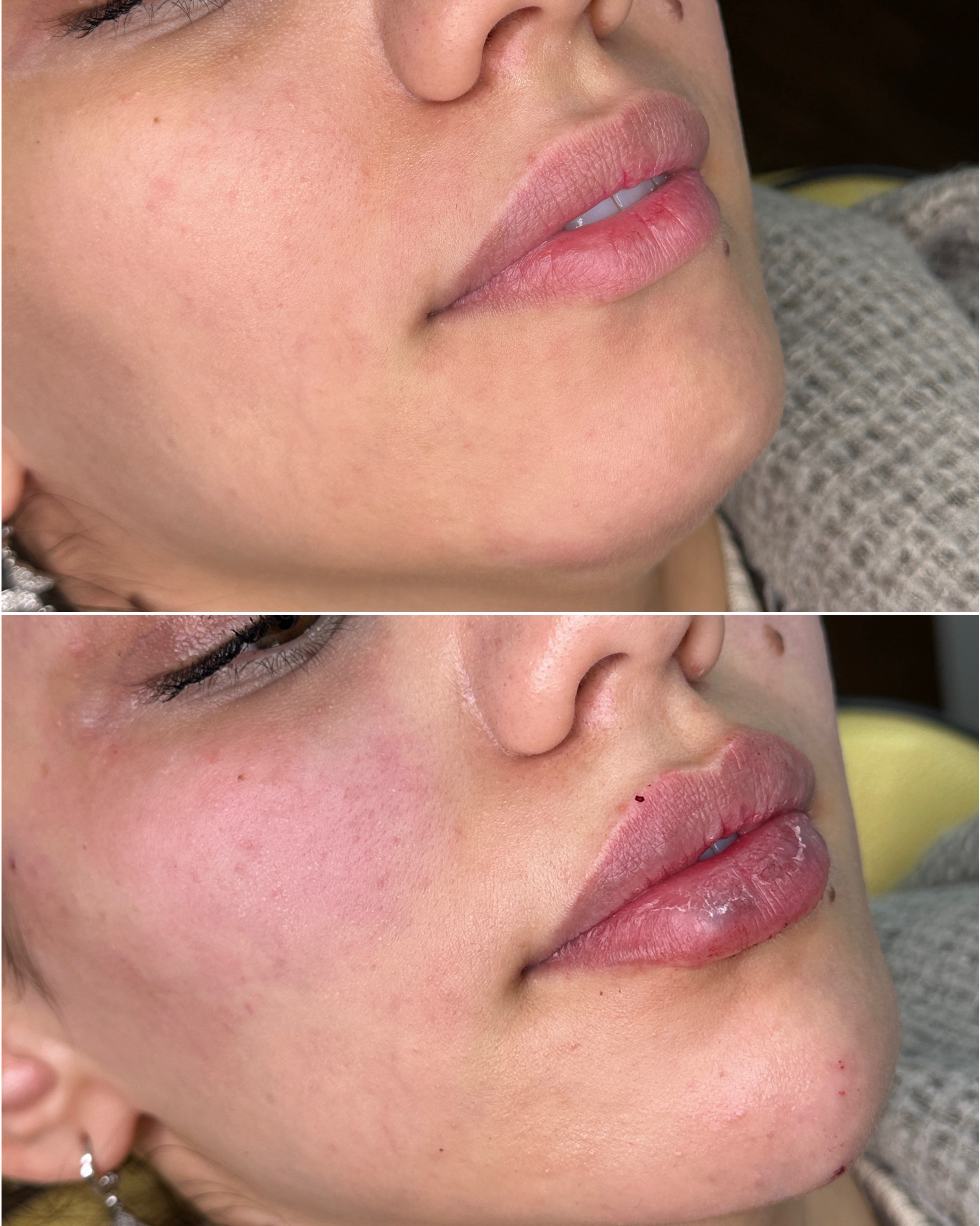نمونه کار دکتر علی قصابان — لیفت و لمینت مژه
