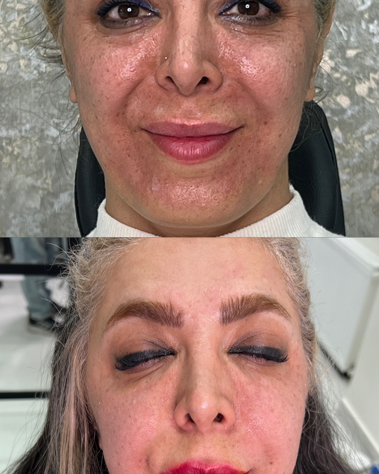 نمونه کار دکتر علی قصابان — لیفت و لمینت مژه