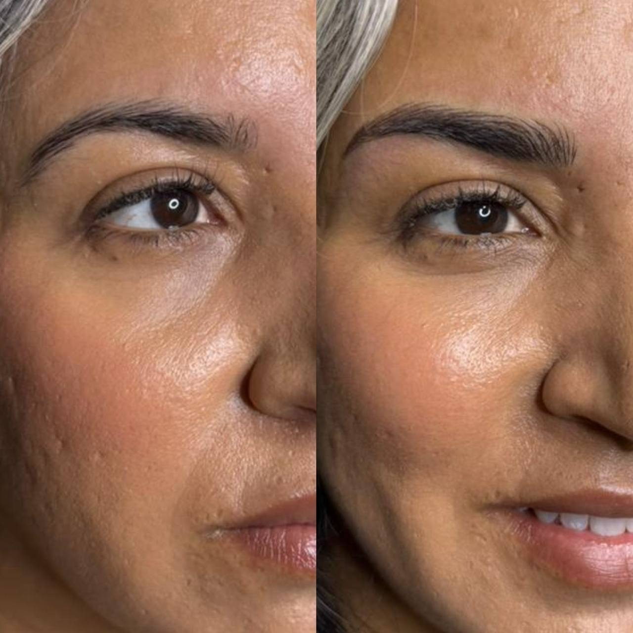 نمونه کار ریحانه کیخواه نژاد — لیفت و لمینت مژه