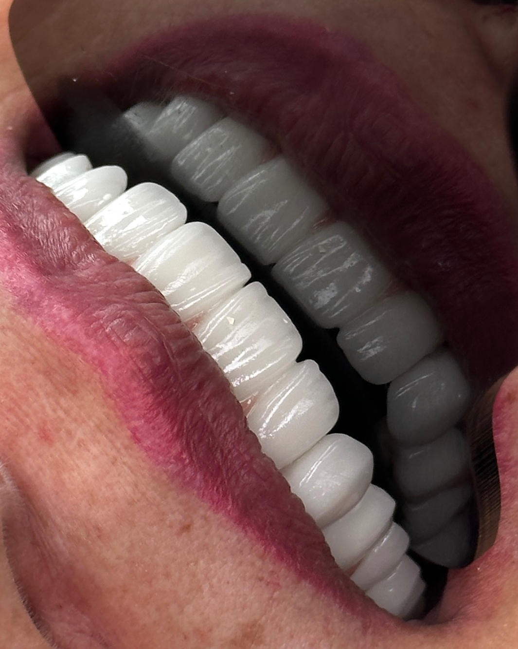 نمونه کار دکتر نگار میر — لیفت و لمینت مژه