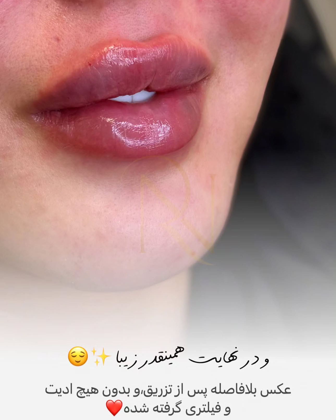 نمونه کار فائزه آزمایش — لیفت و لمینت مژه