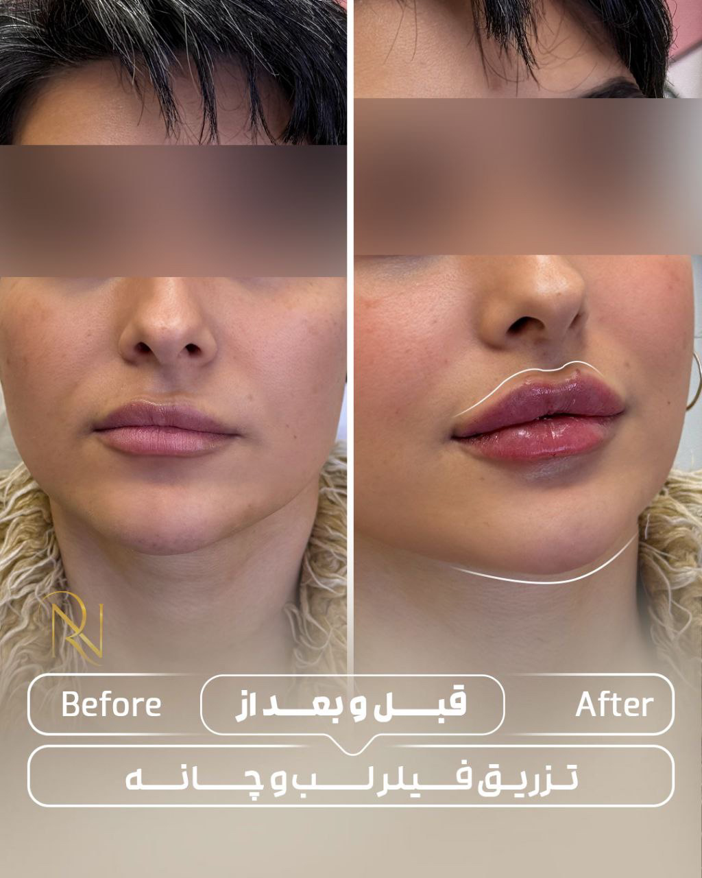 نمونه کار فائزه آزمایش — لیفت و لمینت مژه