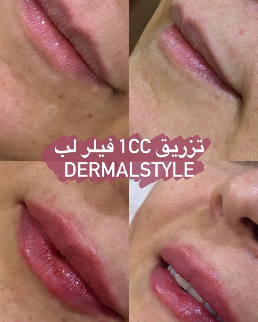 نمونه کار مریم ریسمانکارزاده — لیفت و لمینت مژه