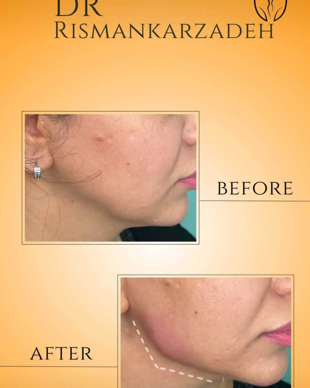 نمونه کار مریم ریسمانکارزاده — لیفت و لمینت مژه