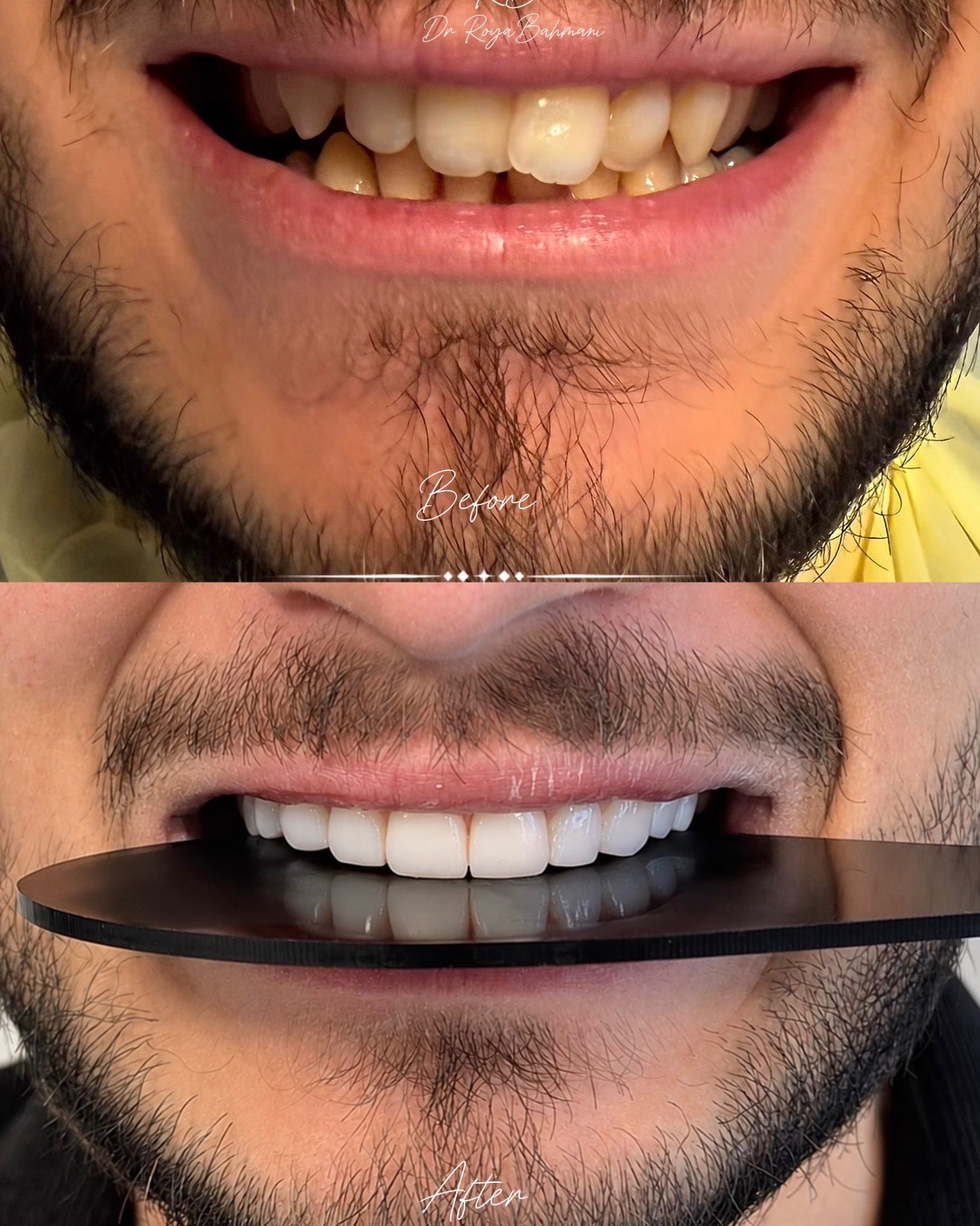 نمونه کار دکتر رویا بهمنی — لیفت و لمینت مژه