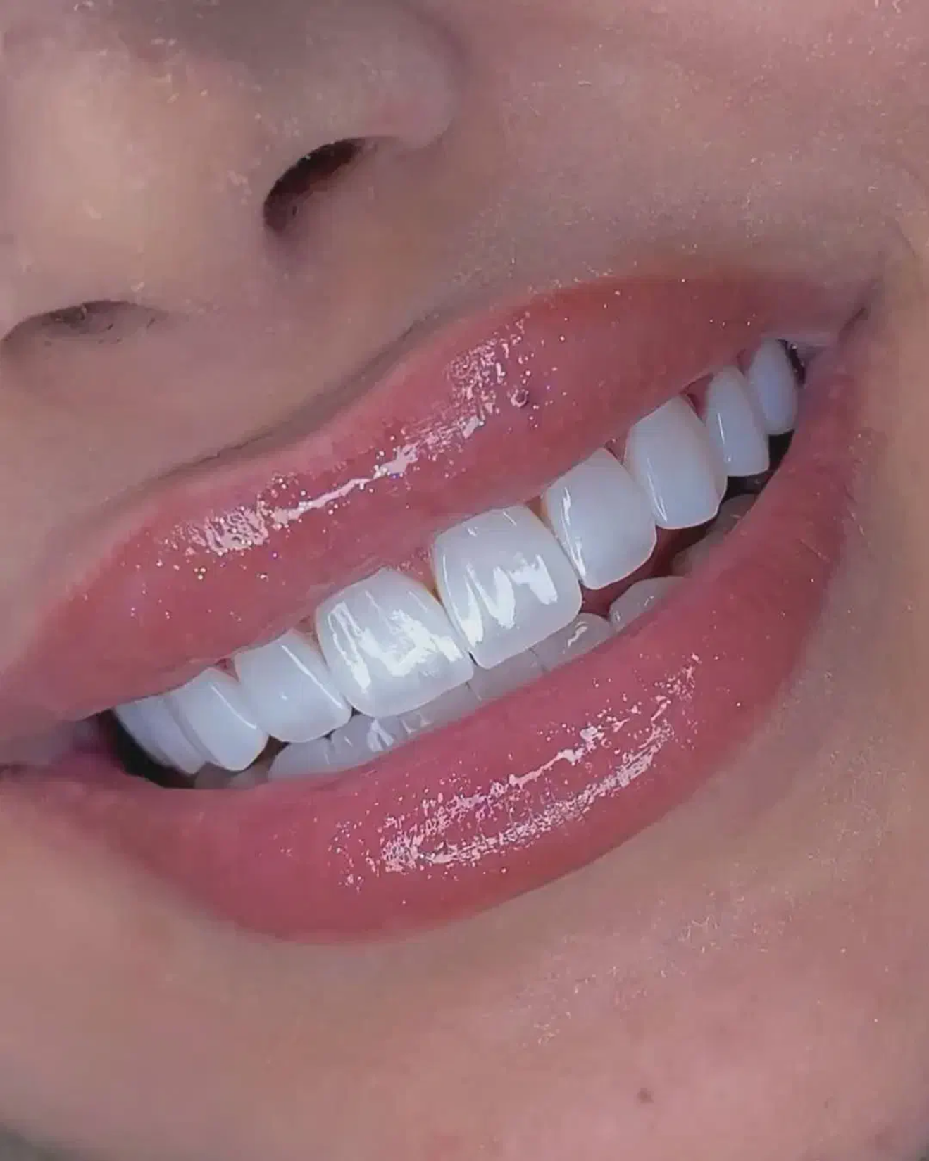 نمونه کار دکتر رویا بهمنی — لیفت و لمینت مژه