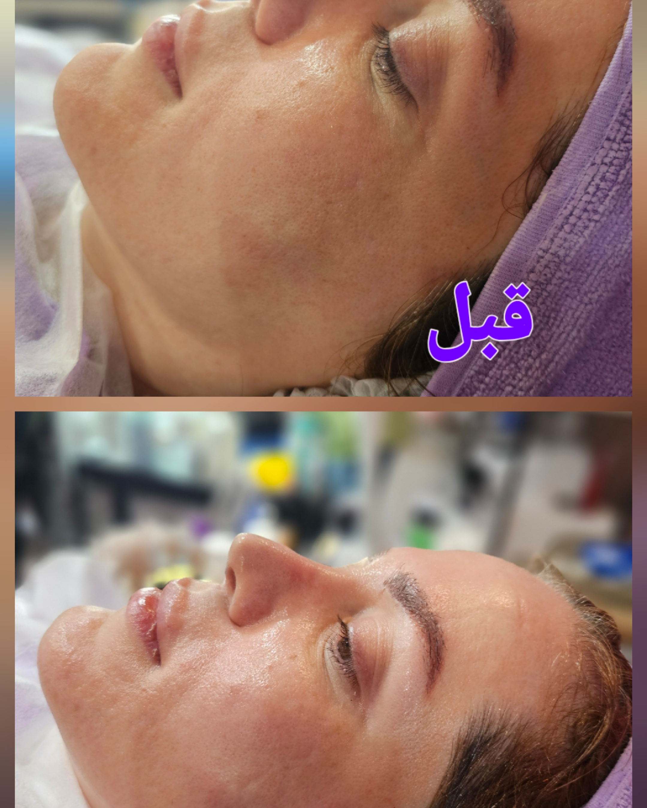 نمونه کار هدیه شعبانی پیردهی — لیفت و لمینت مژه